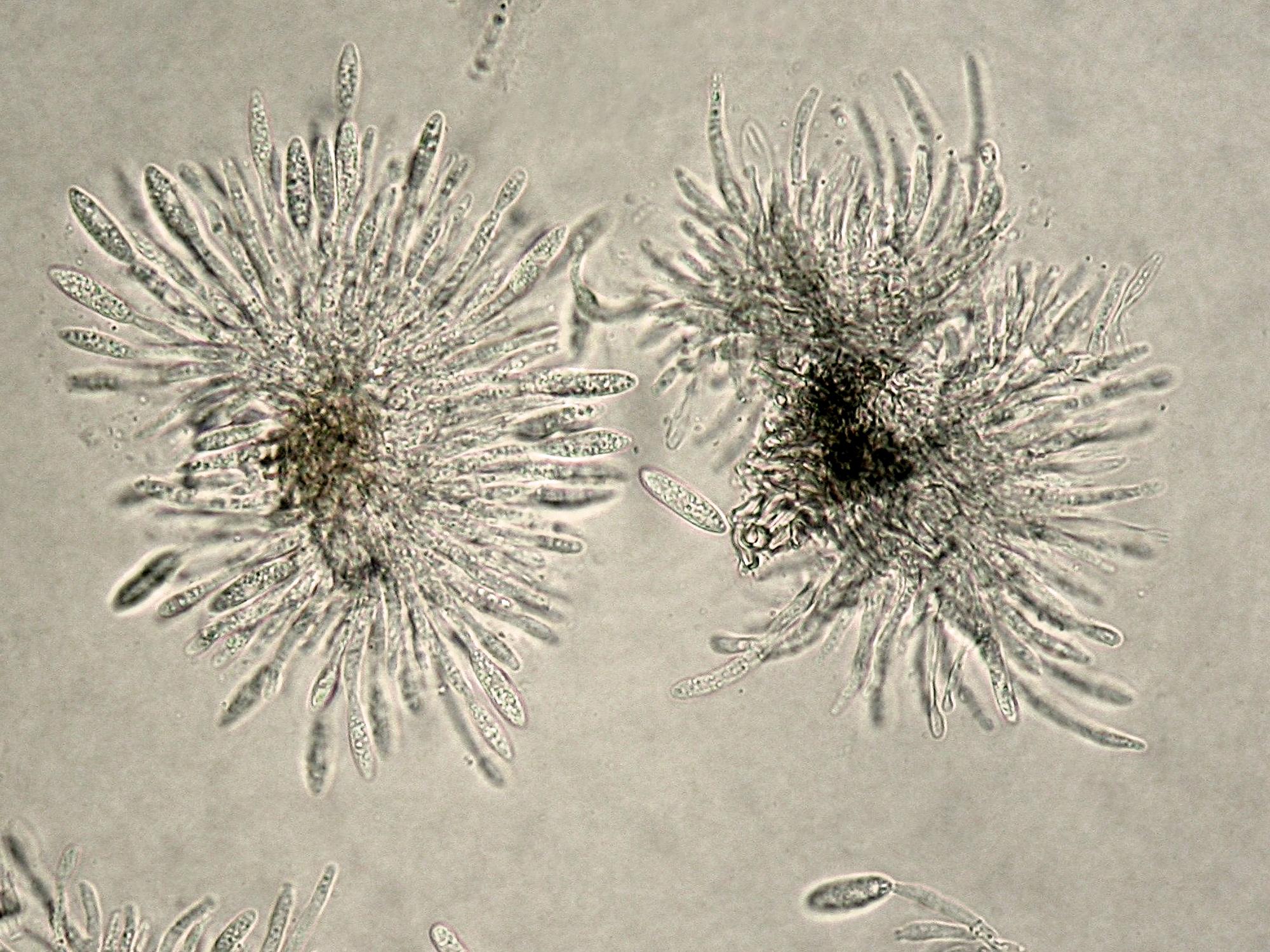 Colletotrichum_acutatum-01
