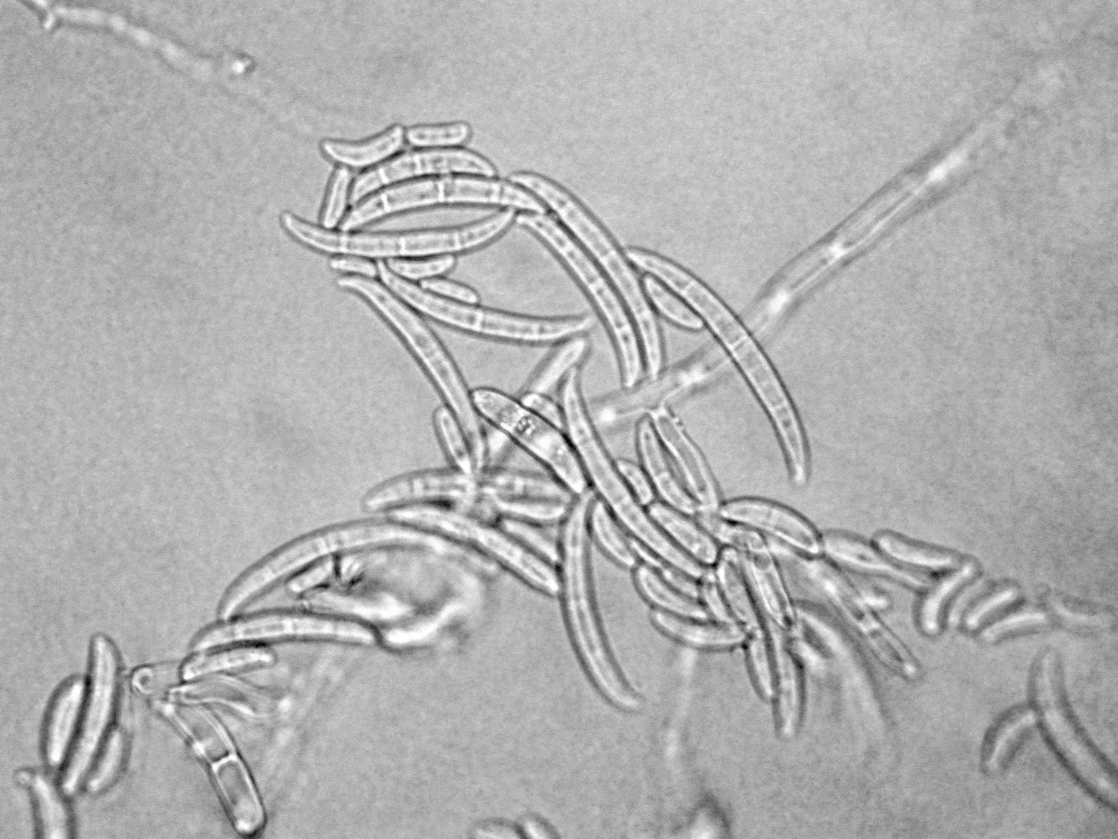 Fusarium_oxysporum_1