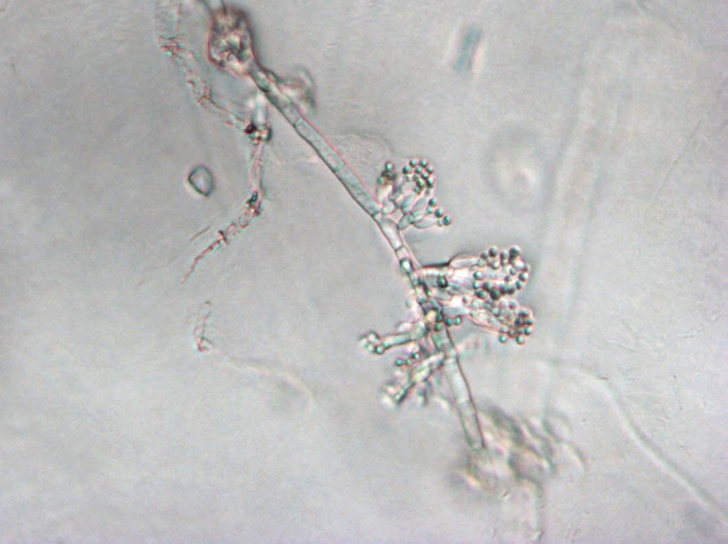 Sclerotium cepivorum conidiophores