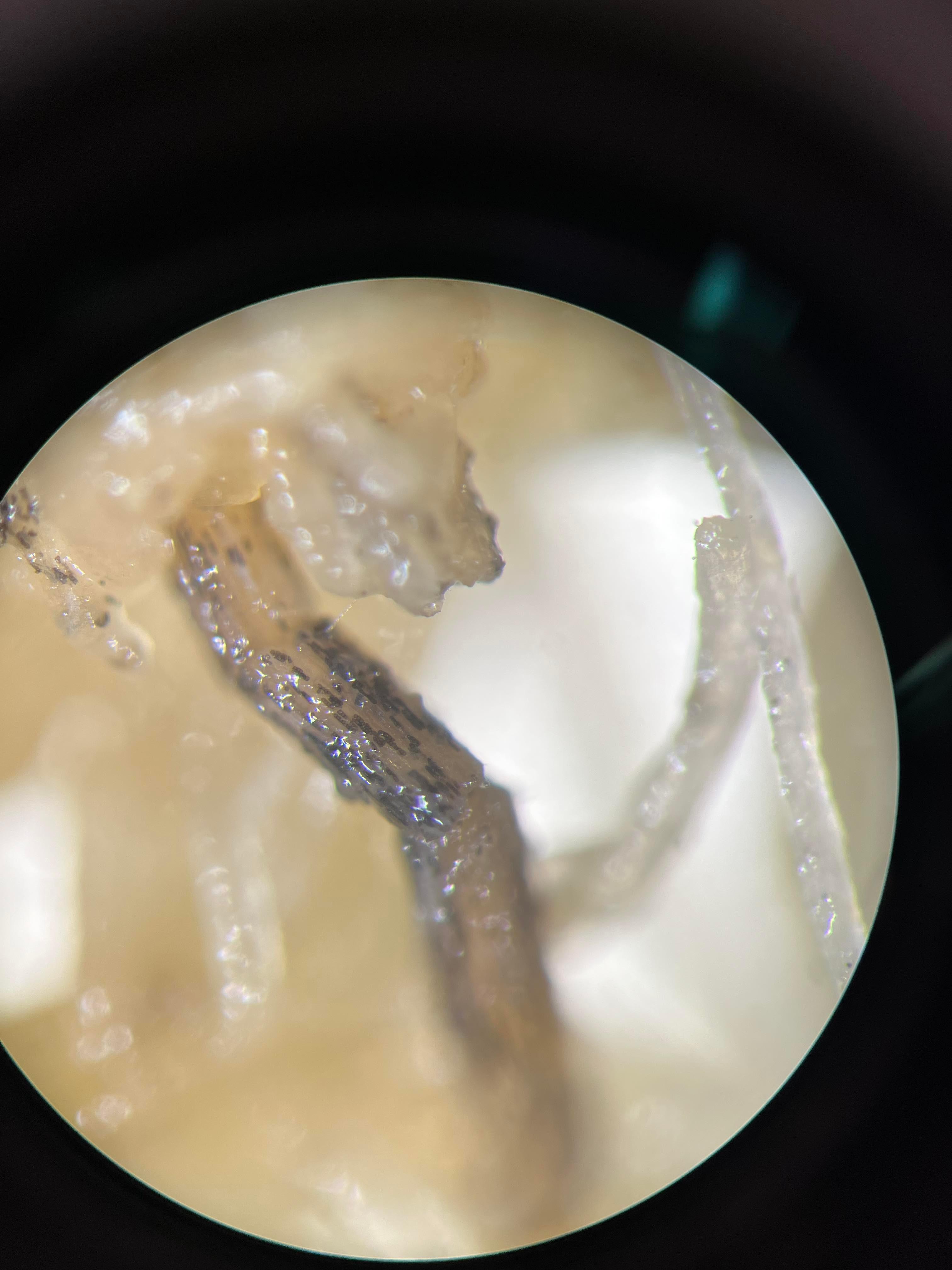 Chlamydospore de Berkeleyomyces sp. (syn. Thielaviopsis) racines cannabis
