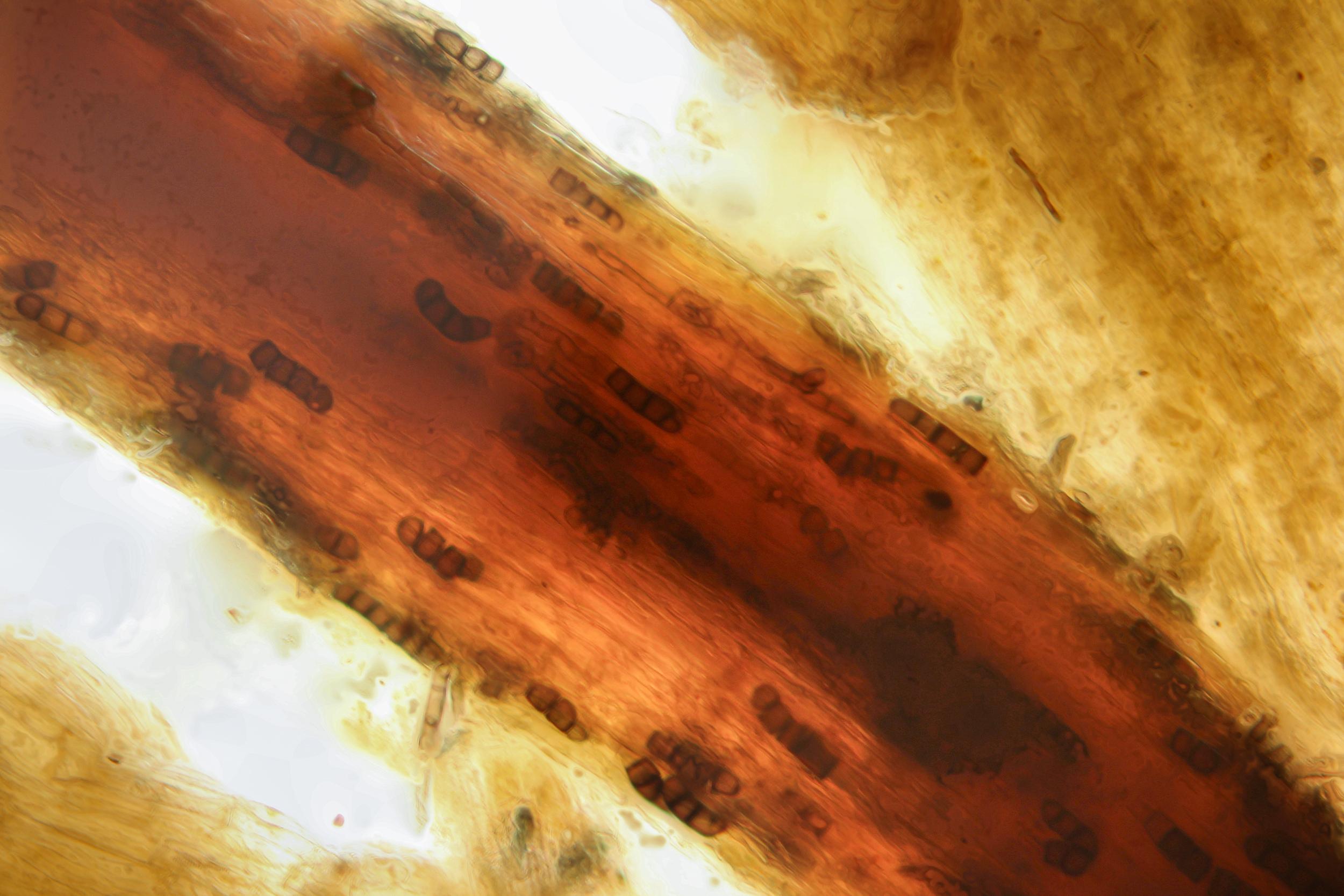 Berkeleyomyces basicola (syn. Thielaviopsis basicola) racine laitue