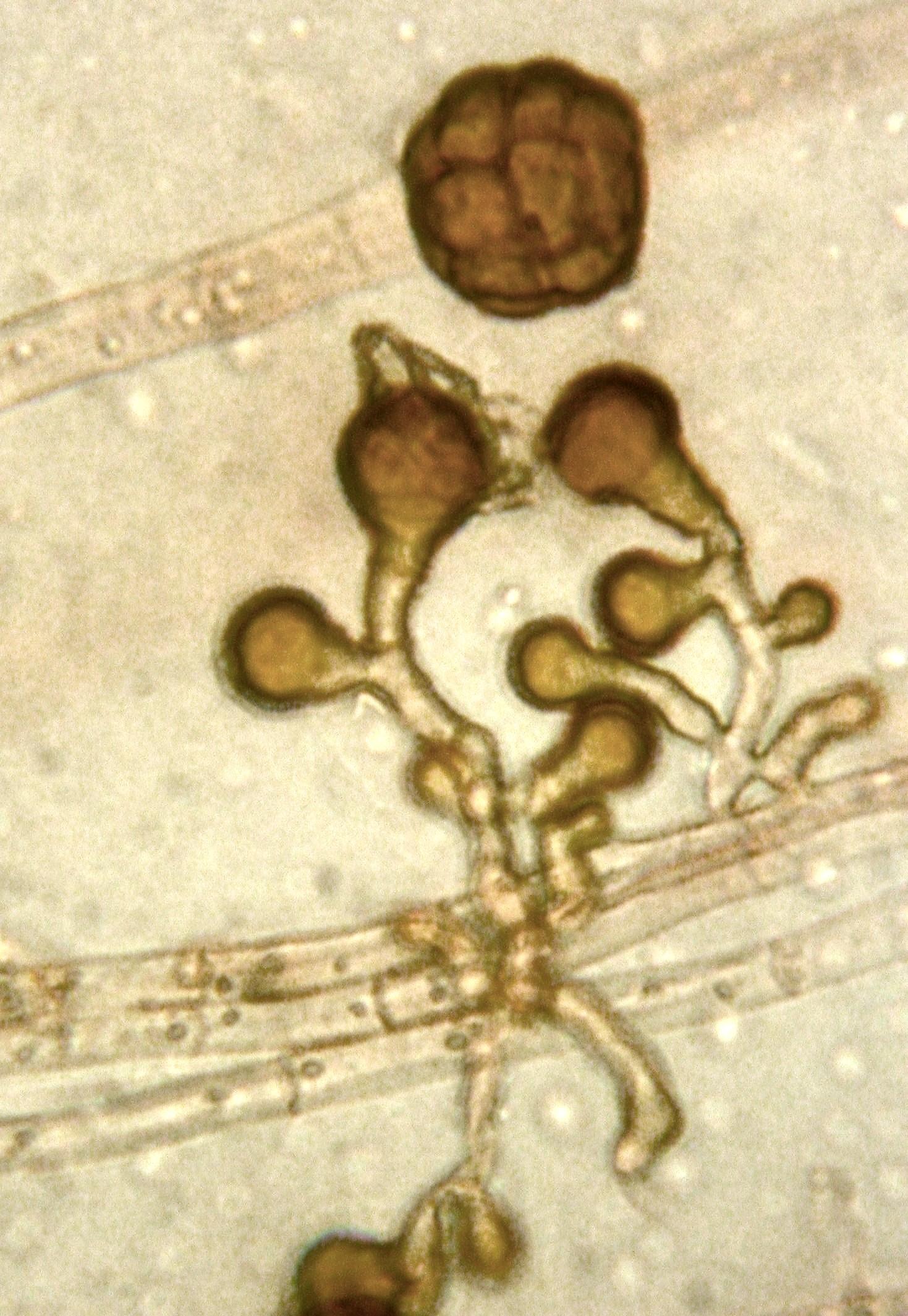 Epicoccum sp.