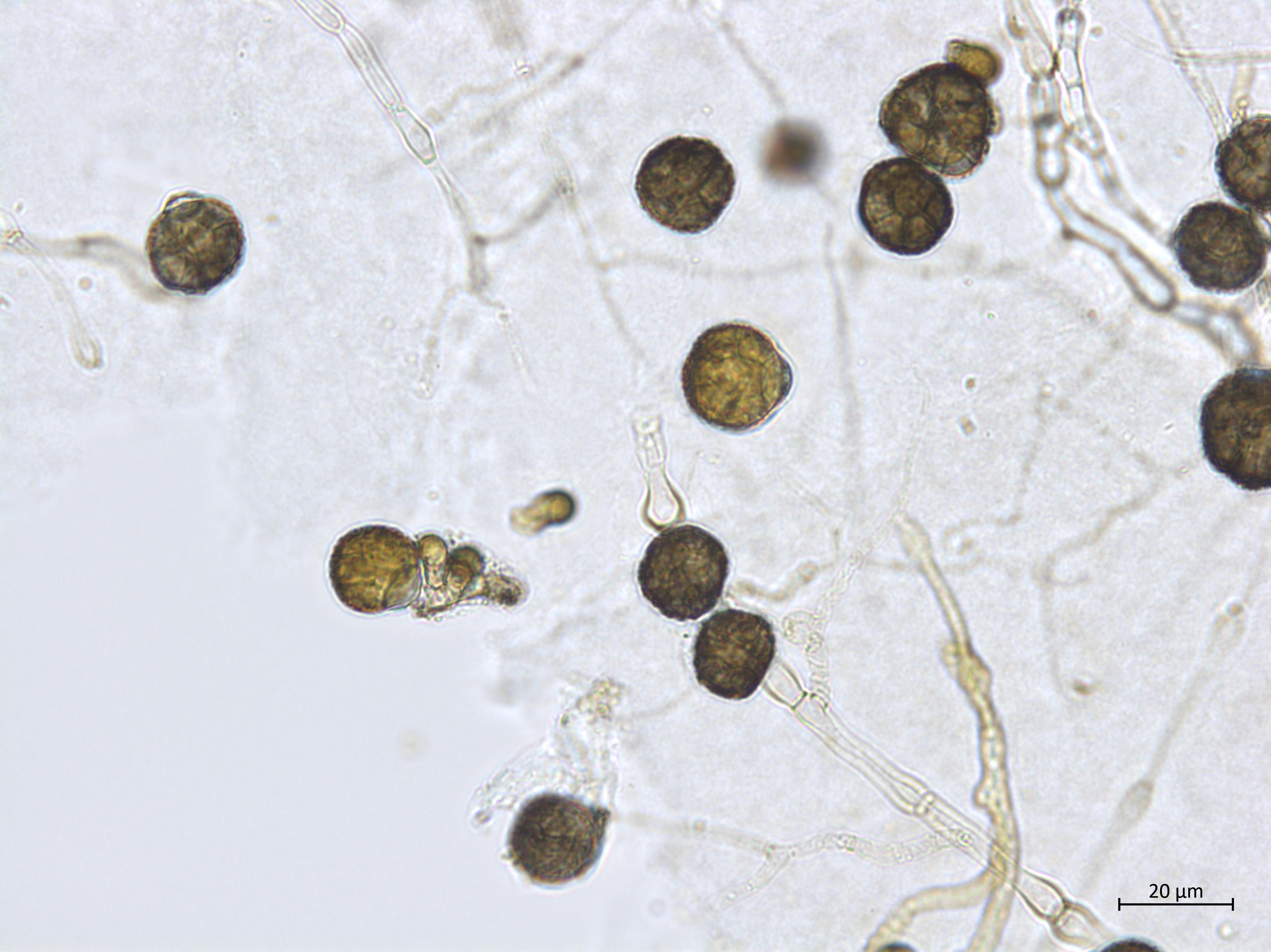 Epicoccum sp.