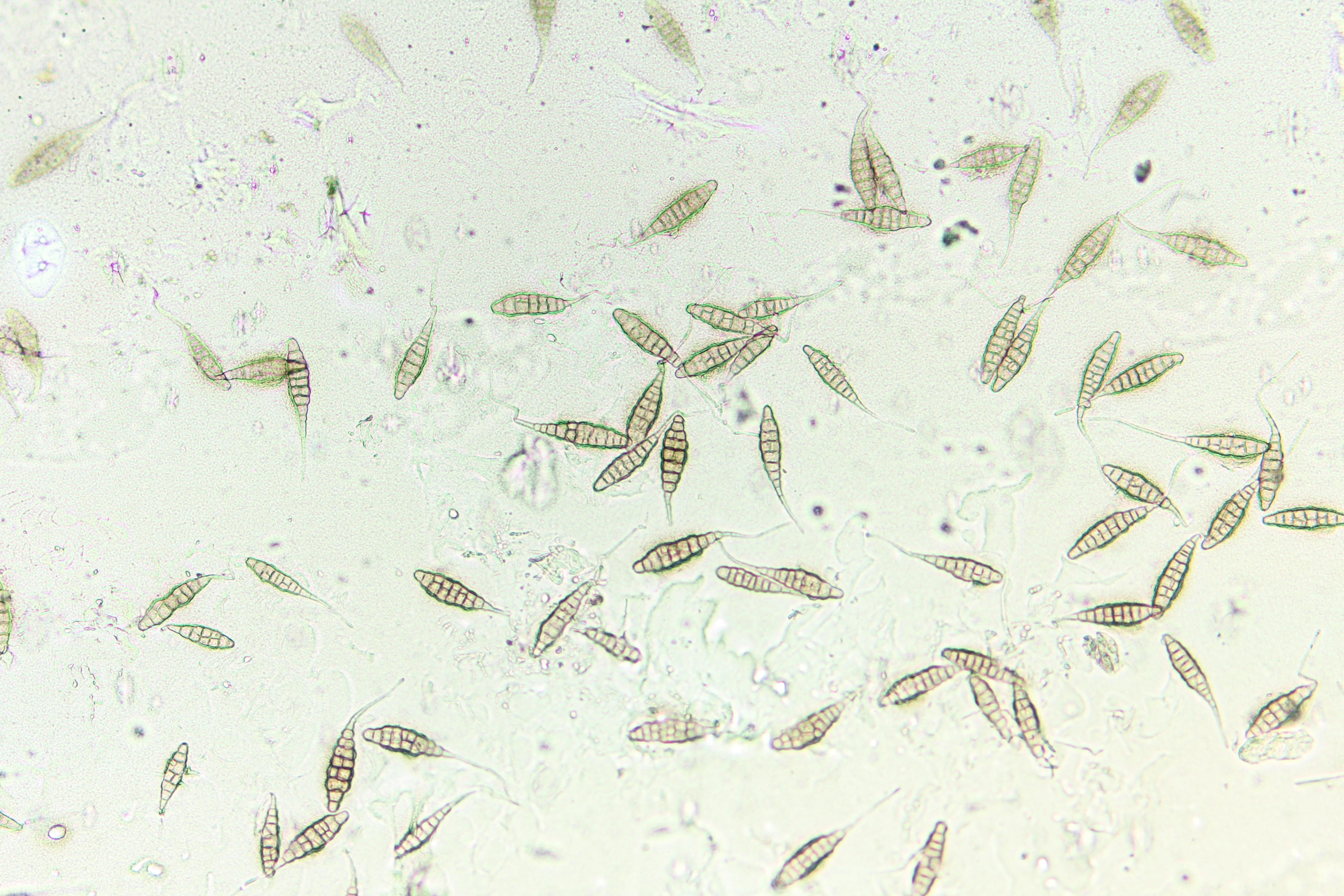 Alternaria sp.