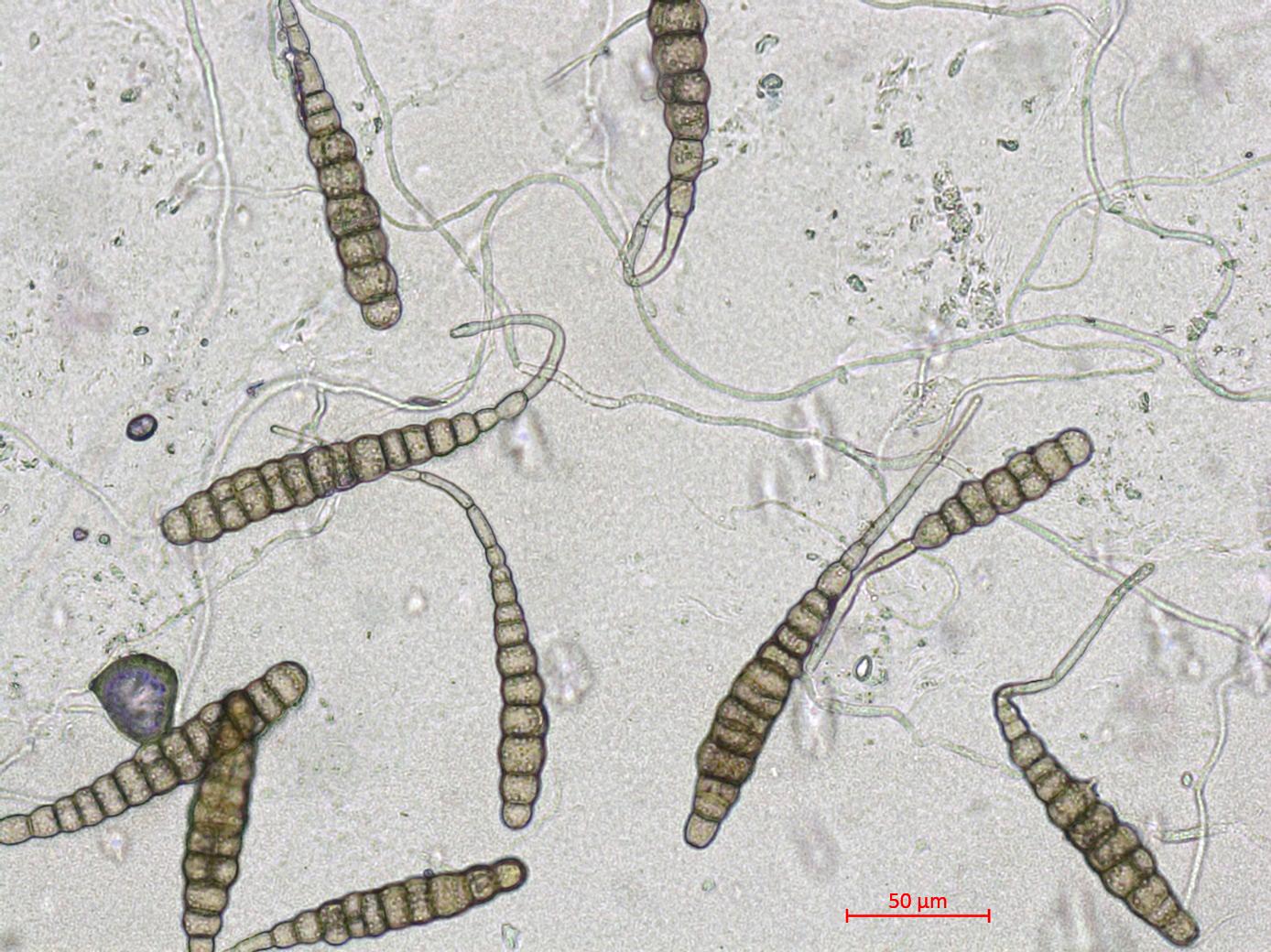 Conidie d'Alternaria solani