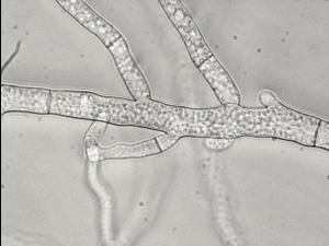 Sclerotinia sp.