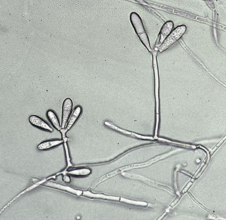Arthrobotrys-04