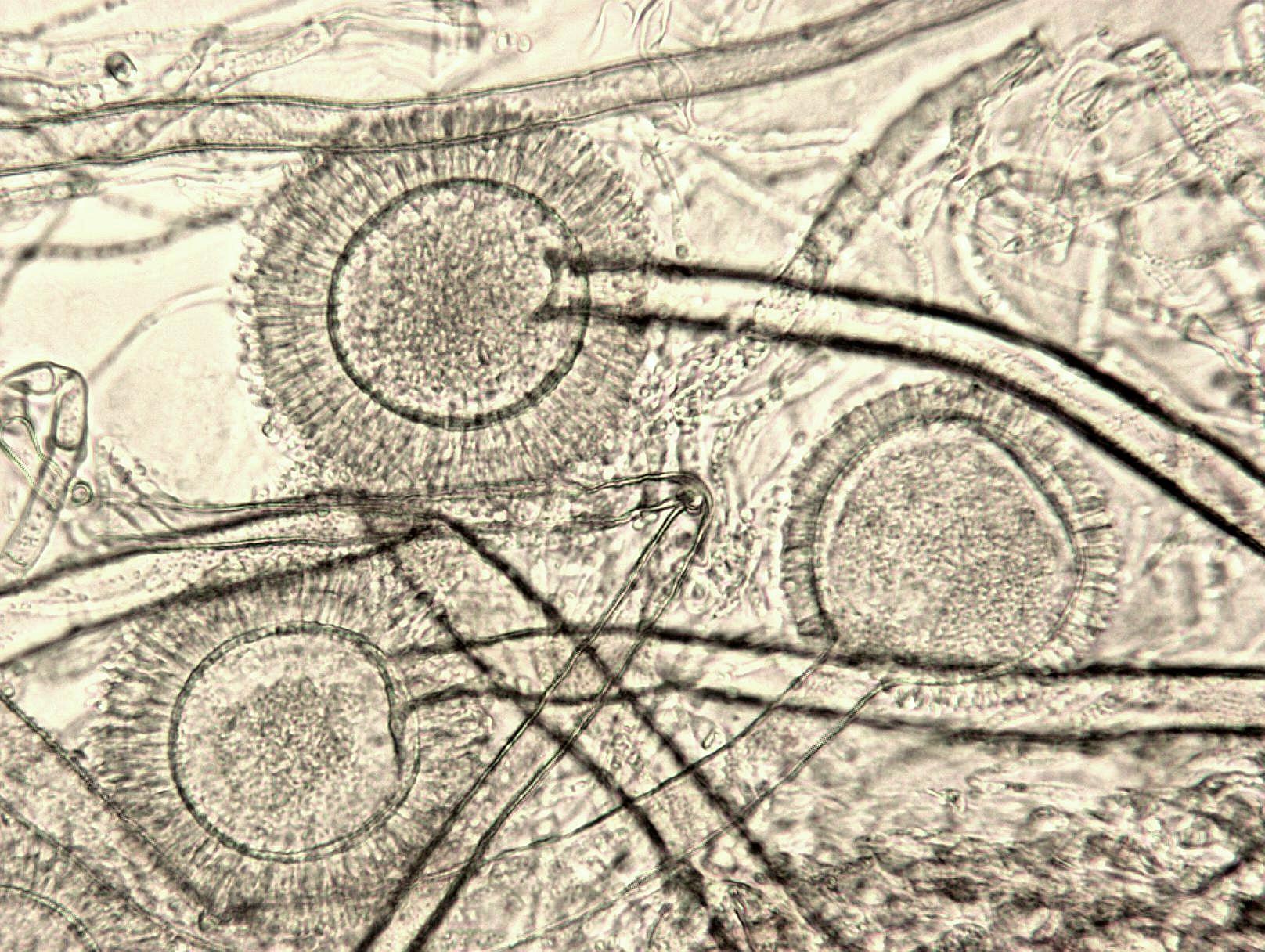 Aspergillus-32_LQ