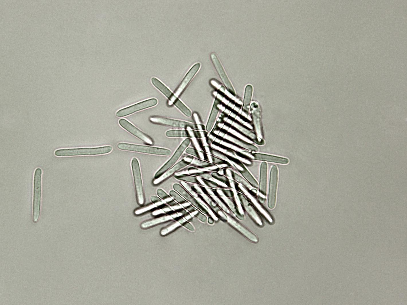 Coleophoma_empetri-06_LQ