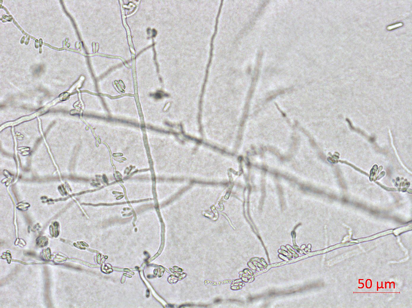 Colletotrichum_coccodes_D35079-1_LQ