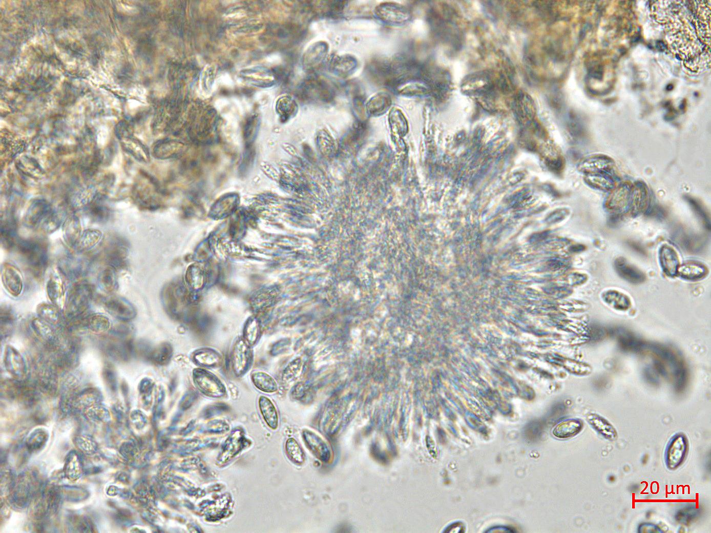 Coniella_diplodiella_D33070-1_LQ