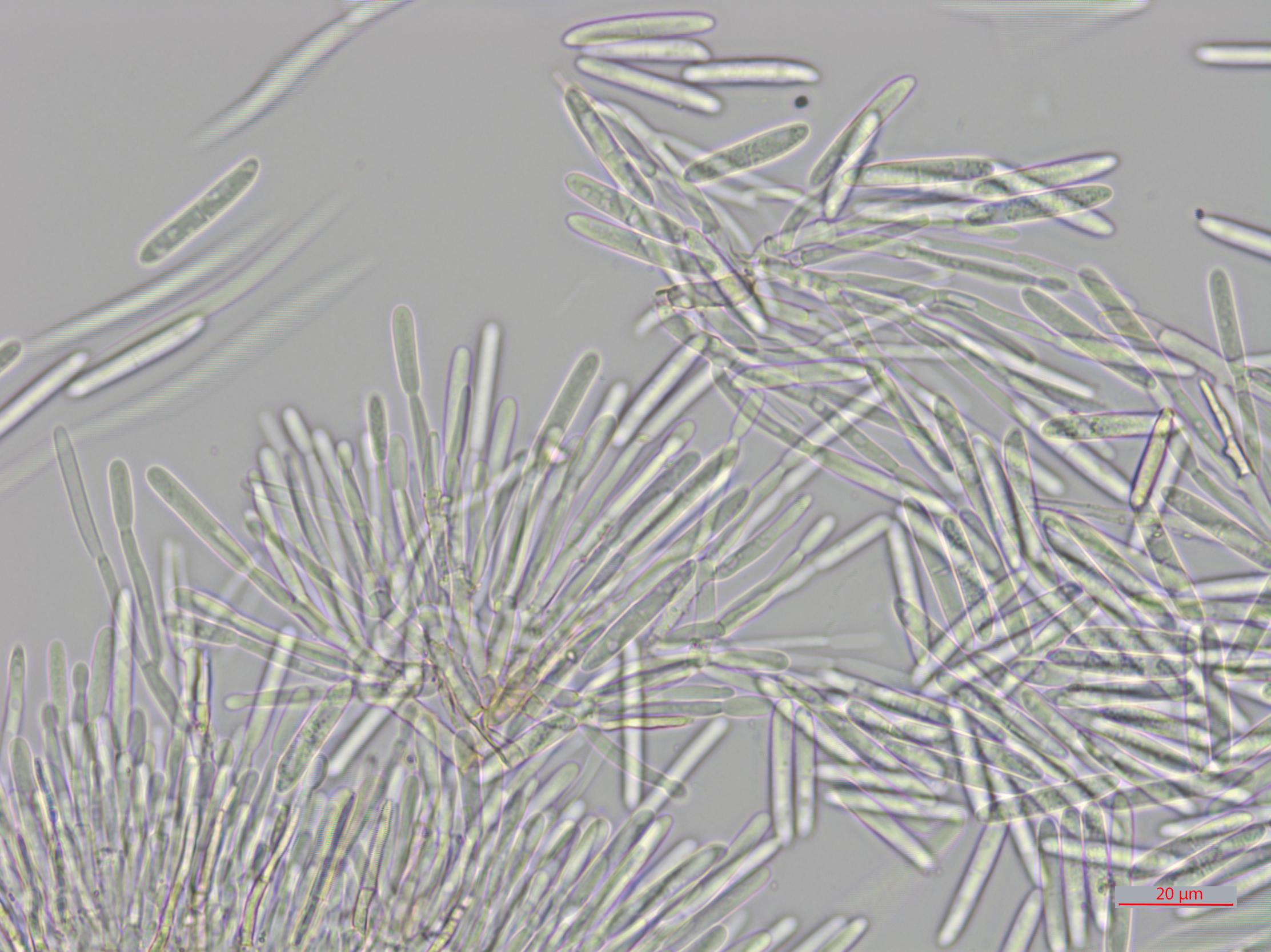 Cylindrocarpon_D34903_LQ