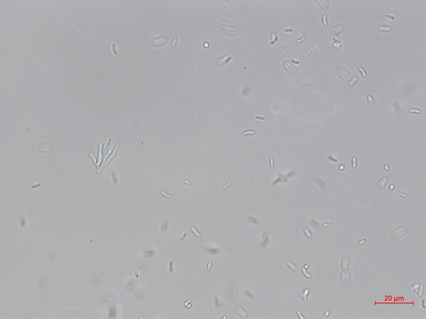Cytospora_leucostoma_D44677-1_Conidies_LQ