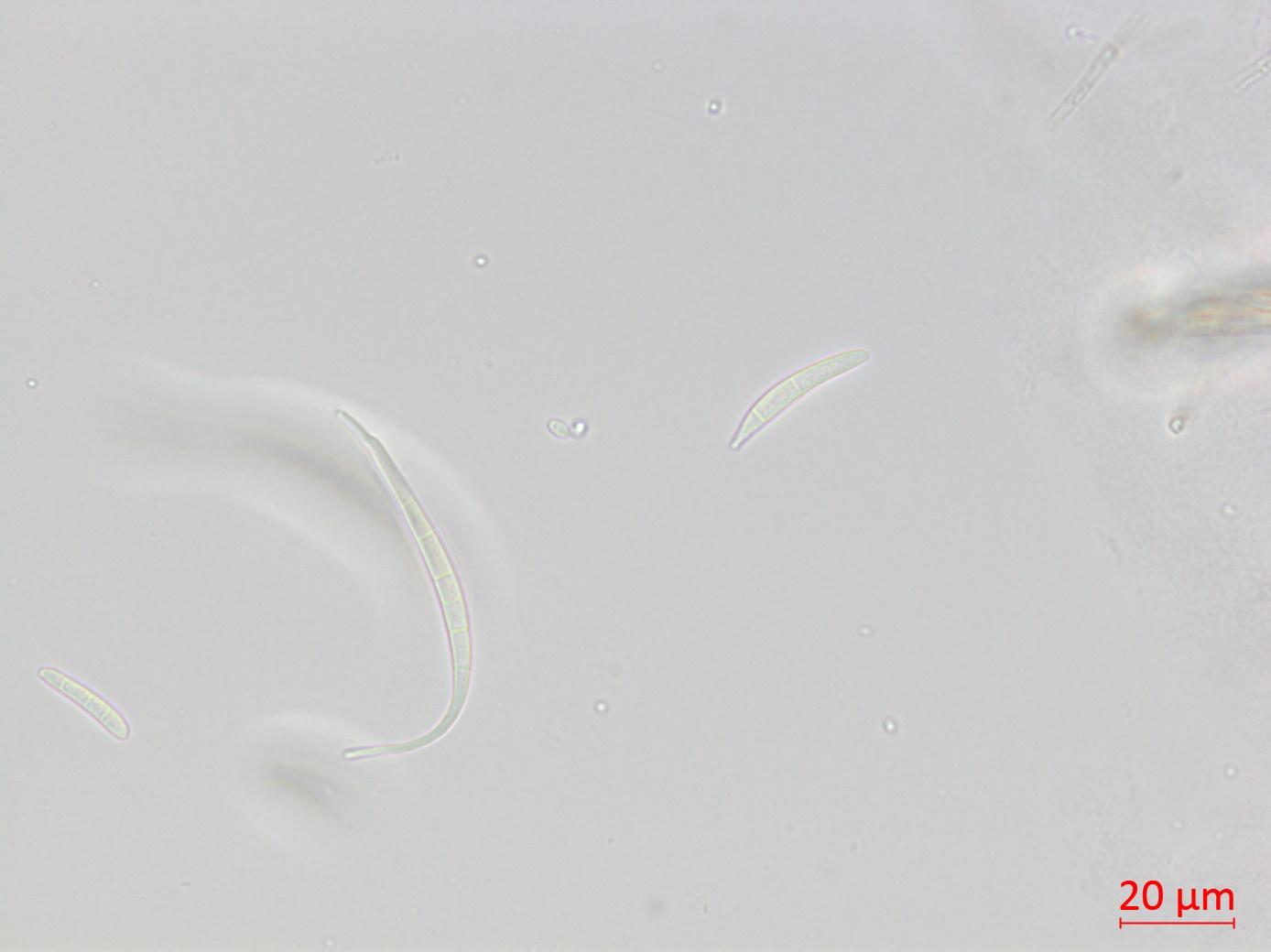 Fusarium_equiseti_2