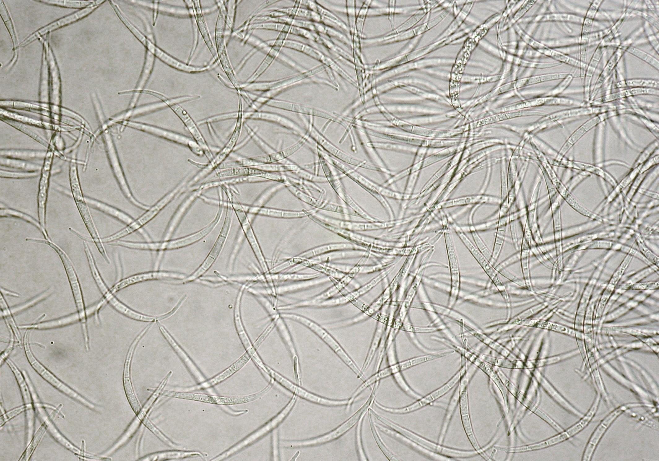 Fusarium_equiseti_5