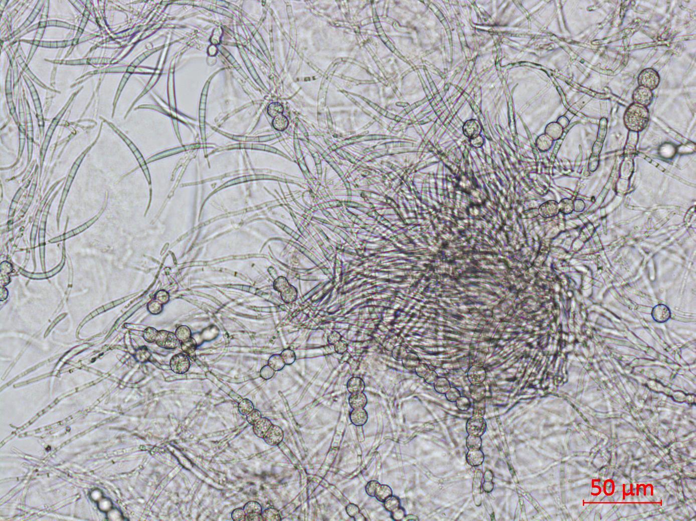 Fusarium_equiseti_3