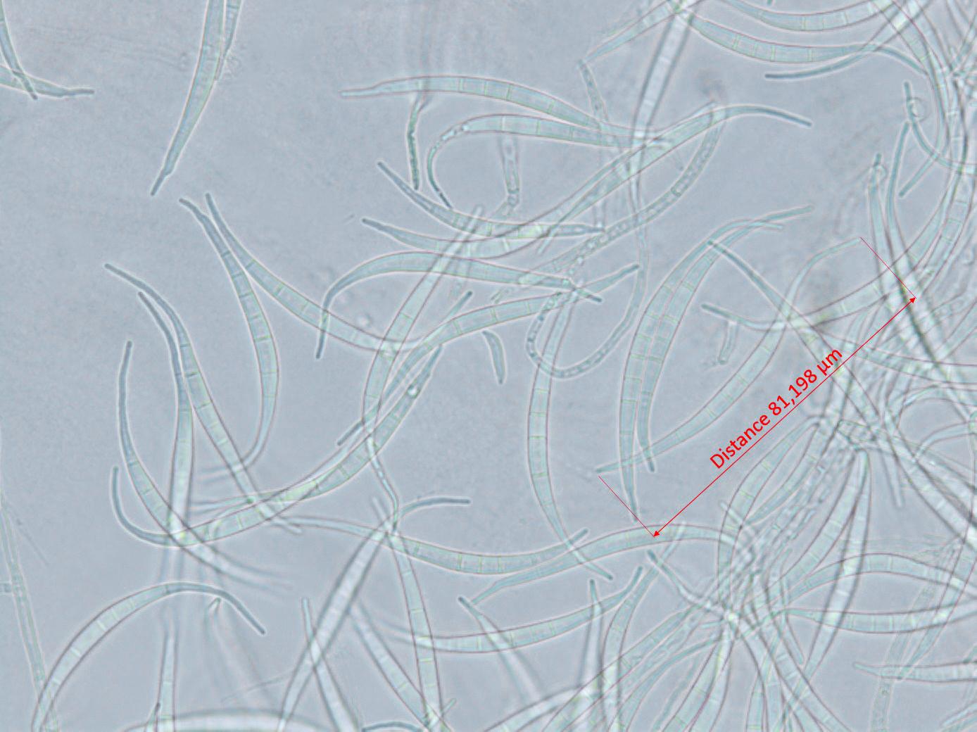 Fusarium_equiseti_4