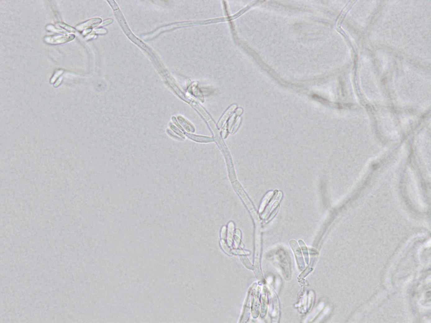 Fusarium_proliferatum_4