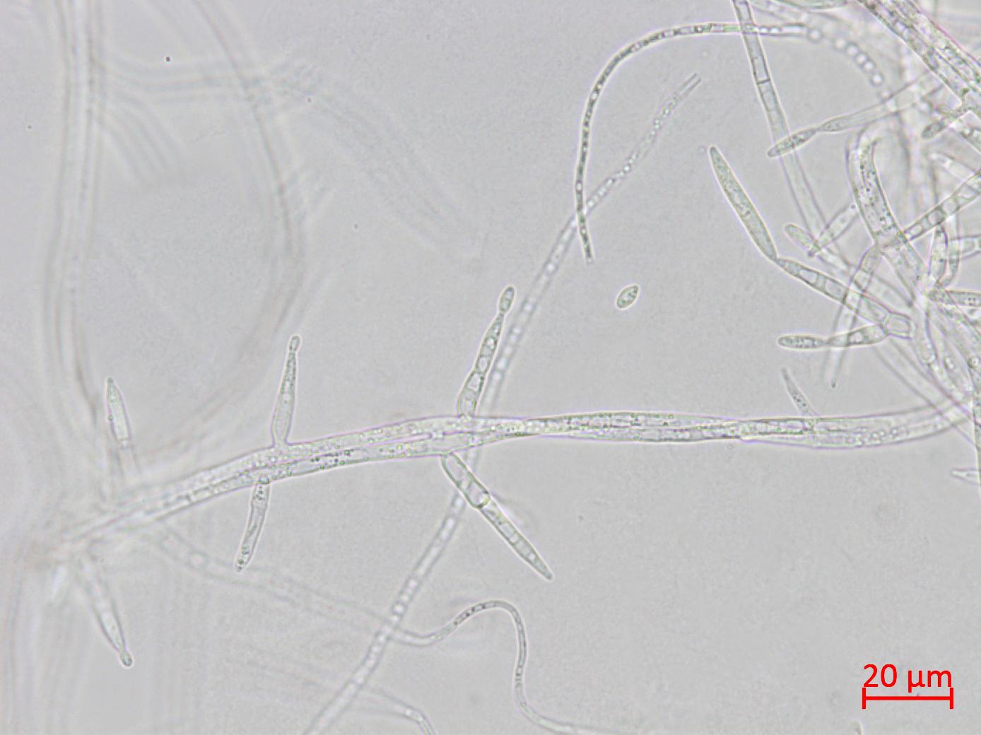 Fusarium_proliferatum_3