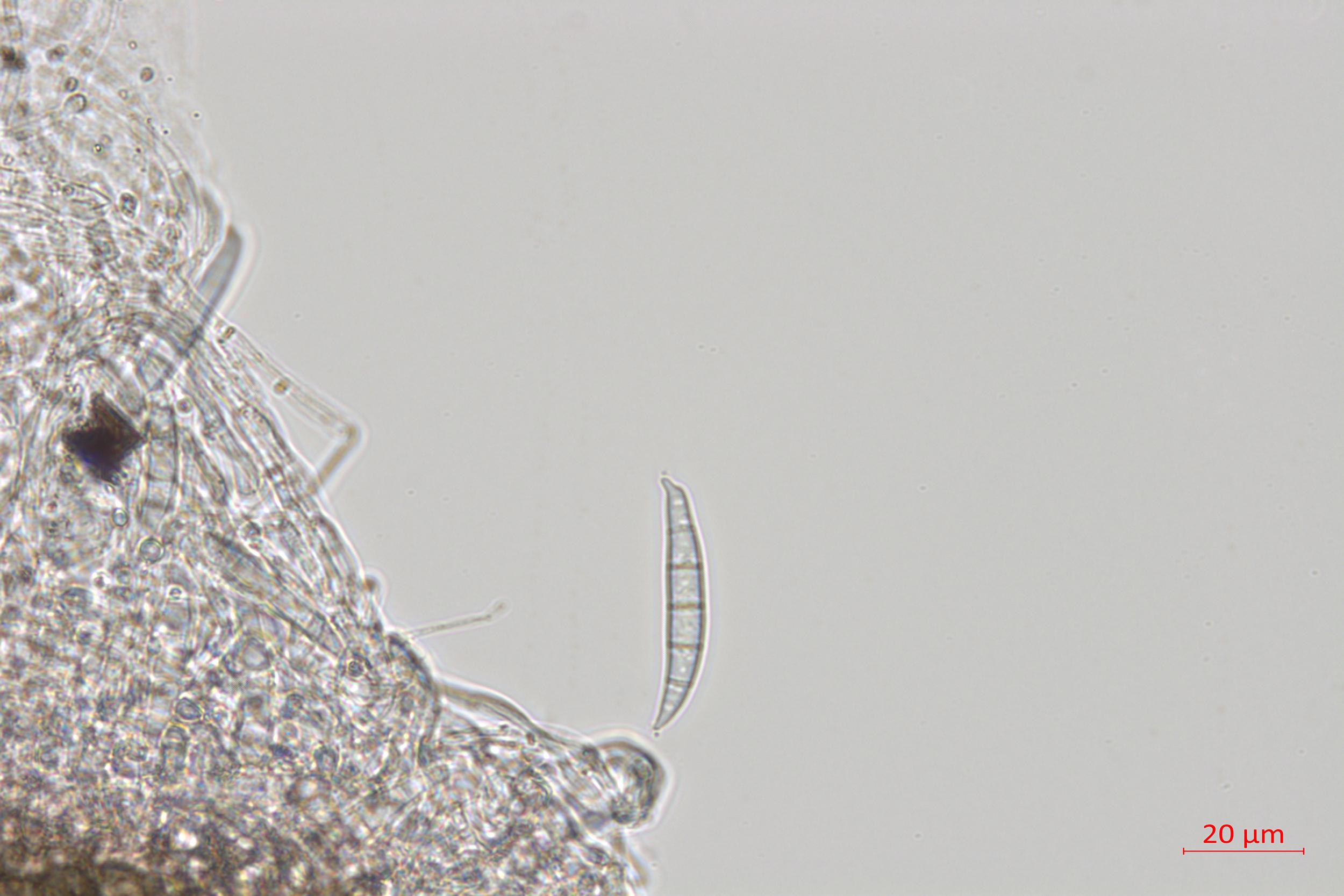Fusarium_sp_4