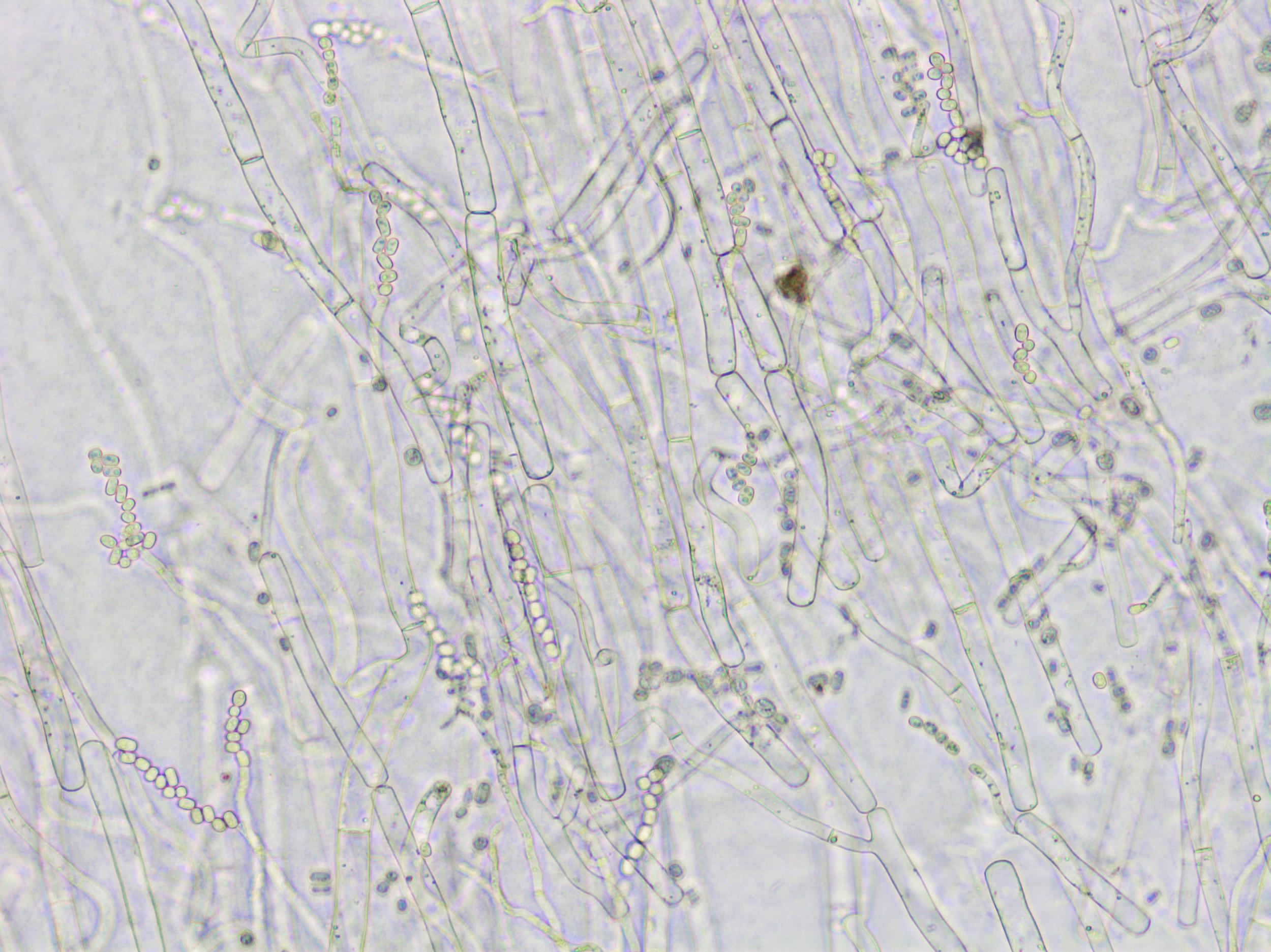 Geotrichum_sp_2