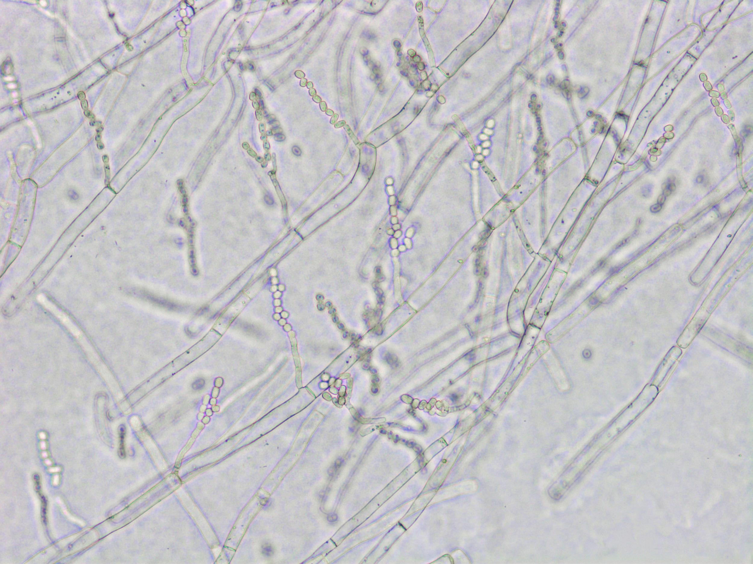 Geotrichum_sp_3