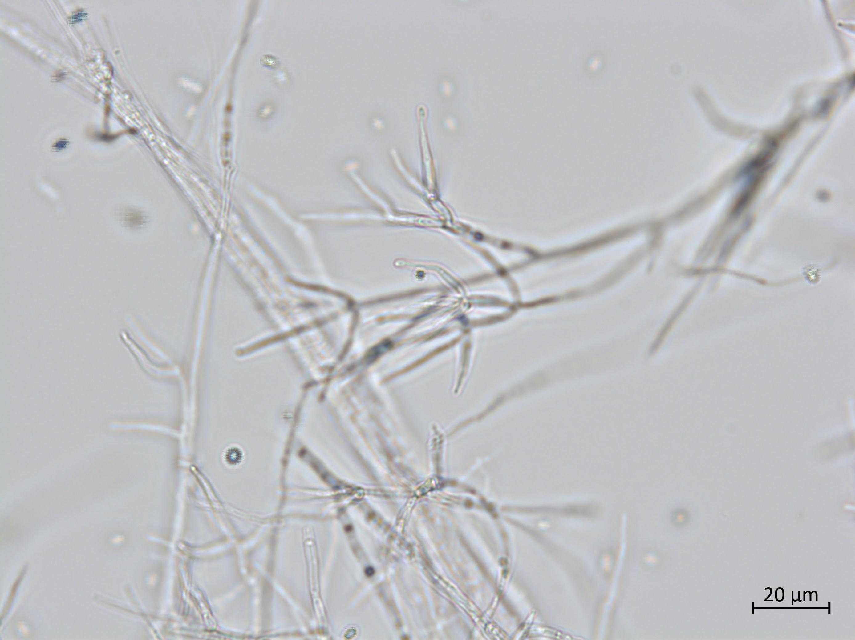 Gibellulopsis_sp_1