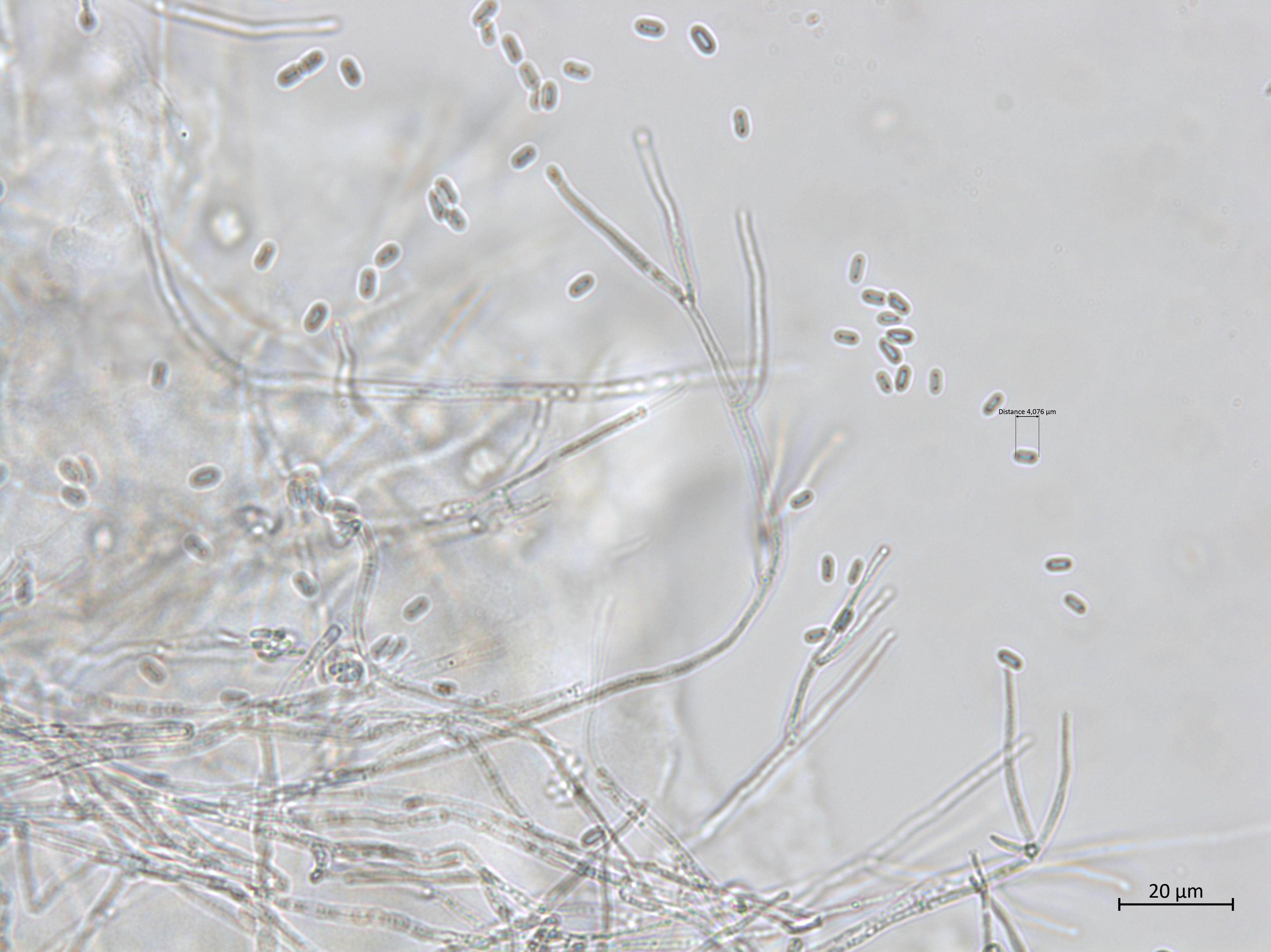 Gibellulopsis_sp_3