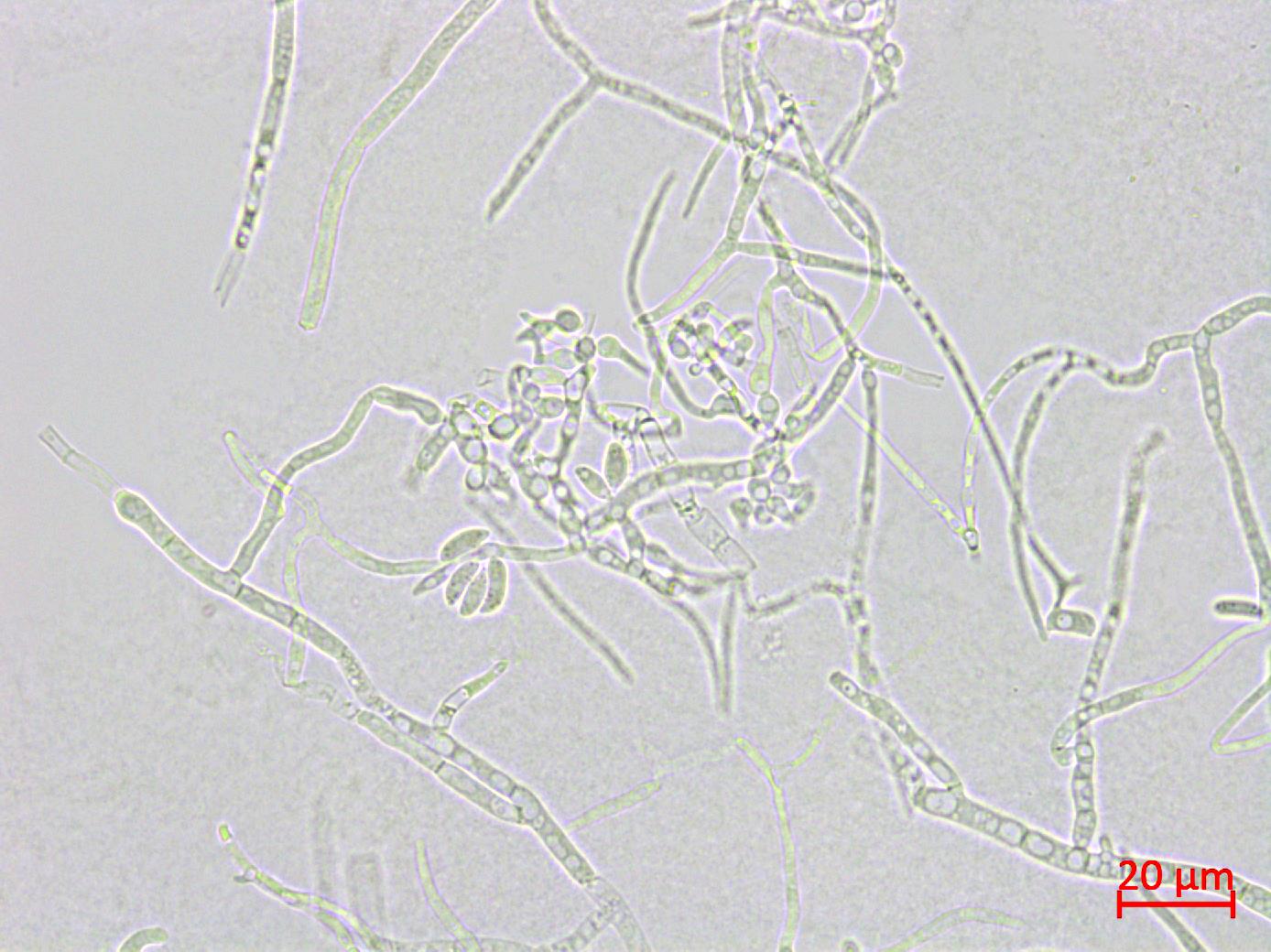 Microdochium_sp_2
