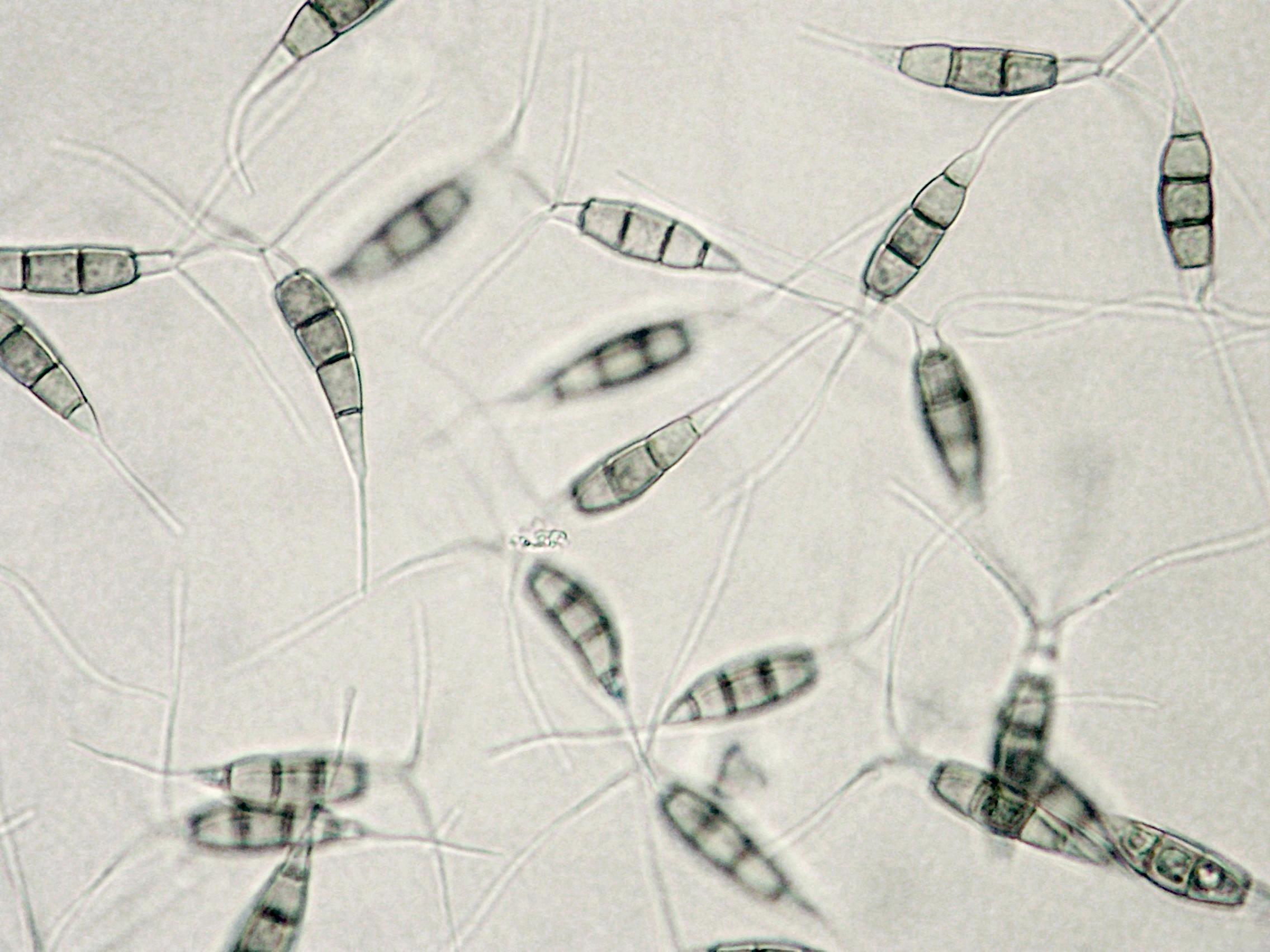 Pestalotiopsis_sp_1