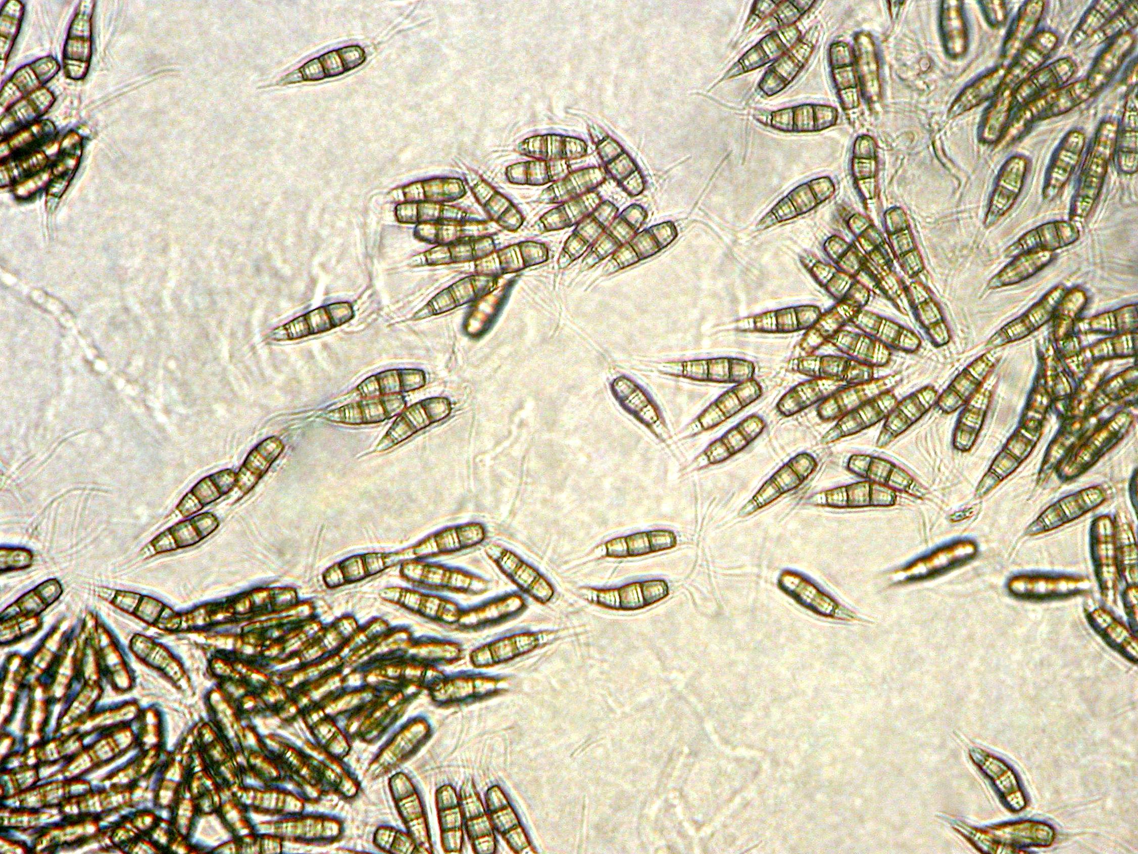 Pestalotiopsis_sp_2