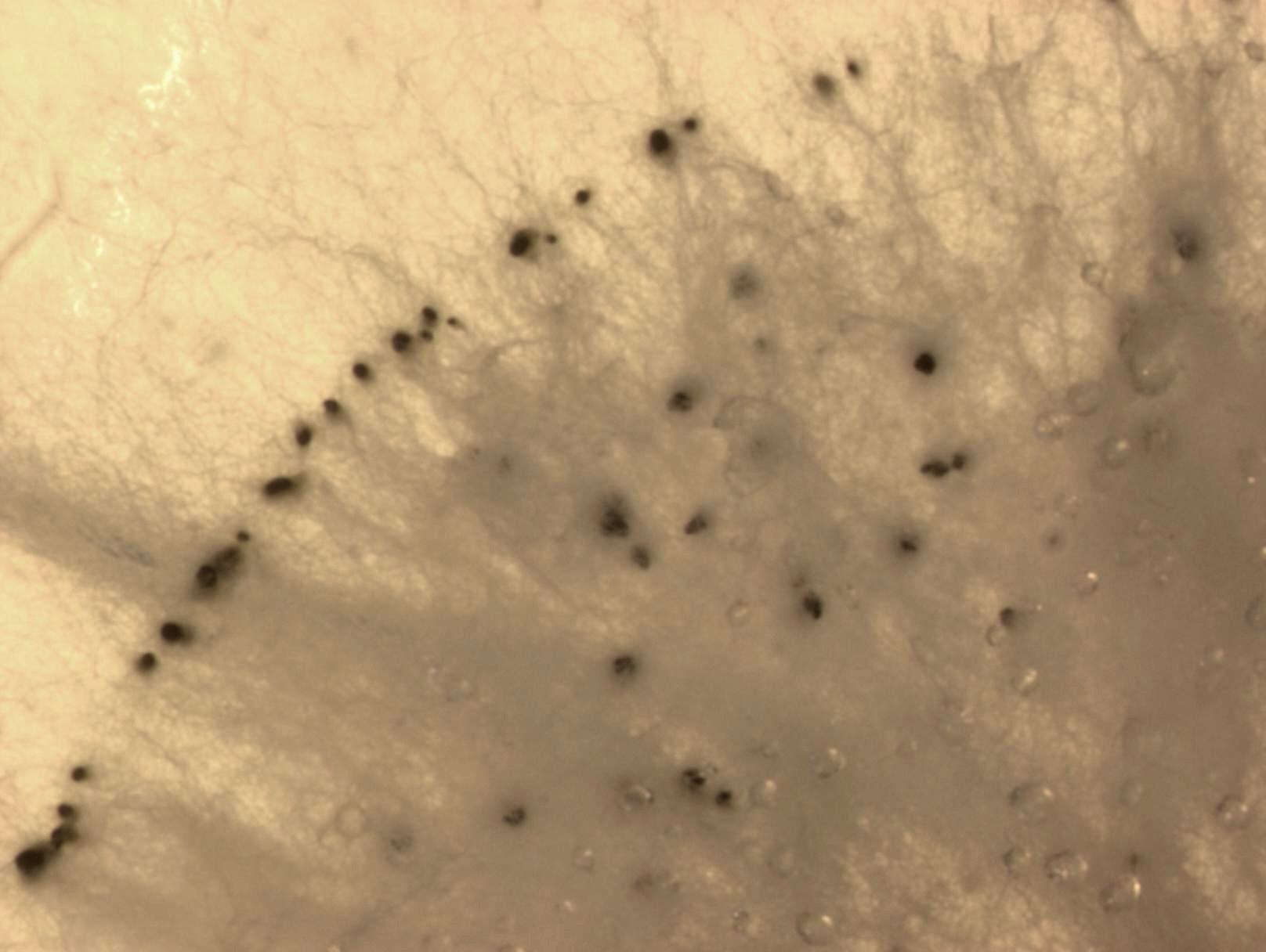 Pestalotiopsis_sp_4