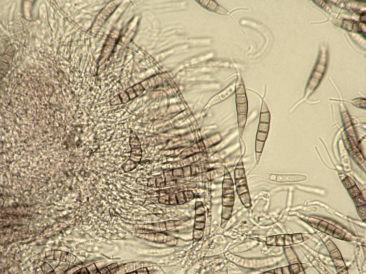 Pestalotiopsis_sp_5