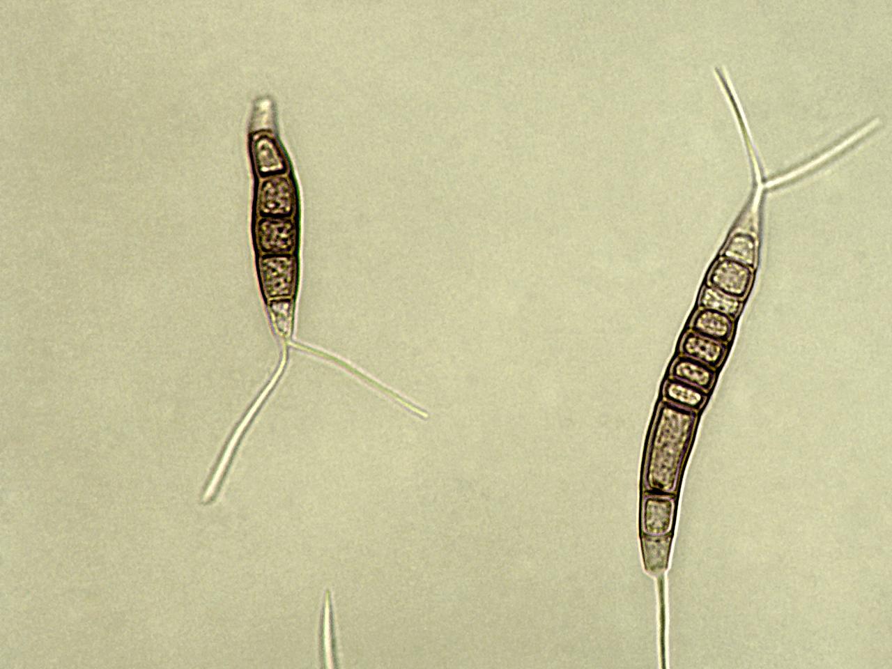 Pestalotiopsis_sp_6