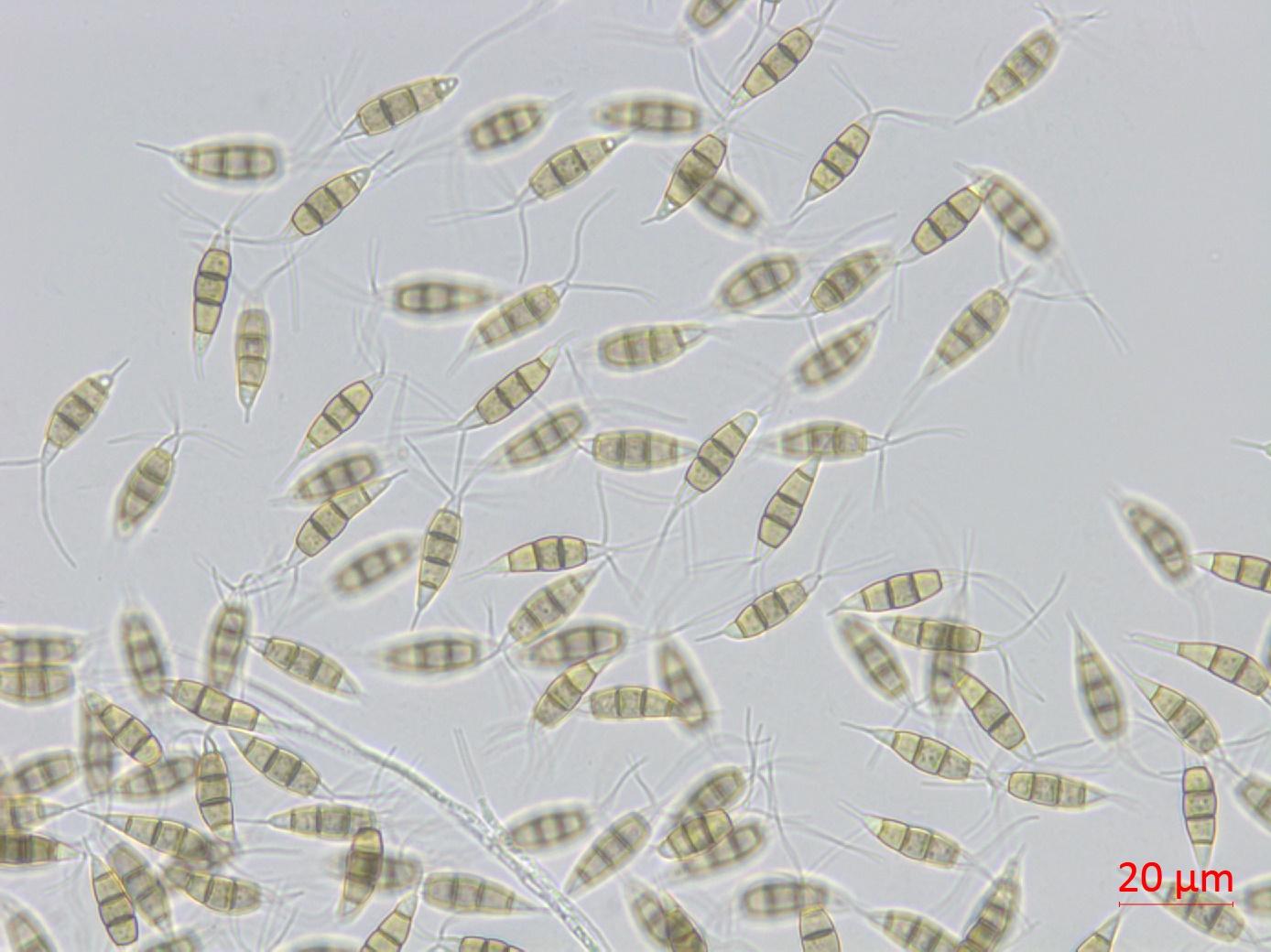 Pestalotiopsis_sp_7