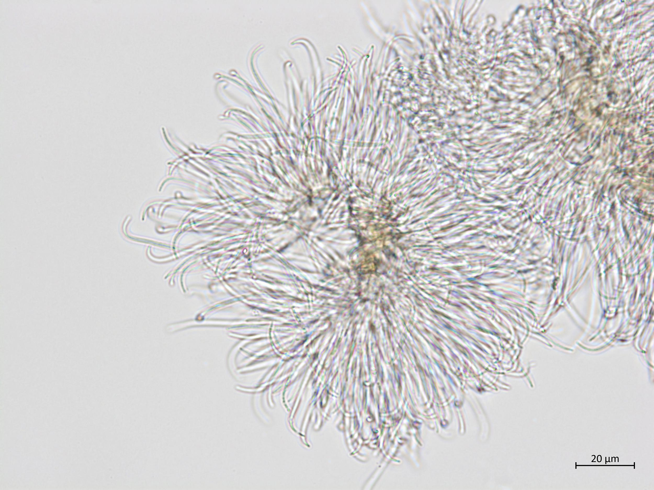Phomopsis_sp_11