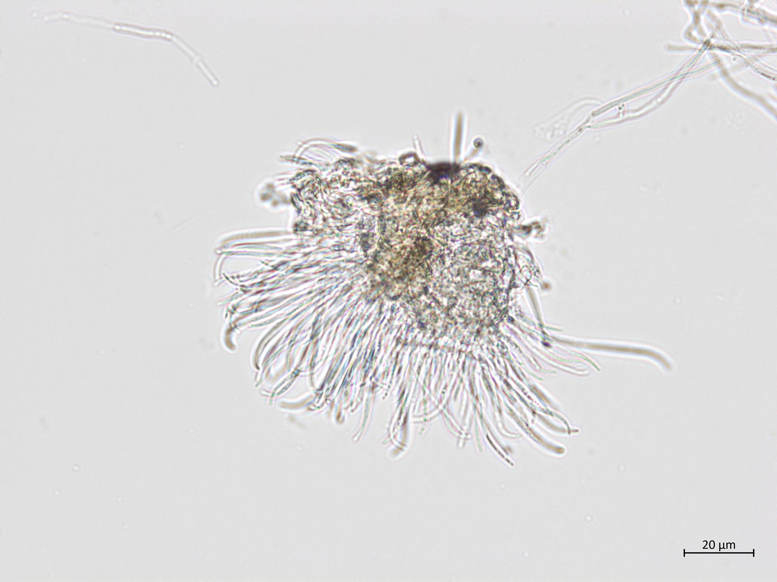 Phomopsis_sp_12