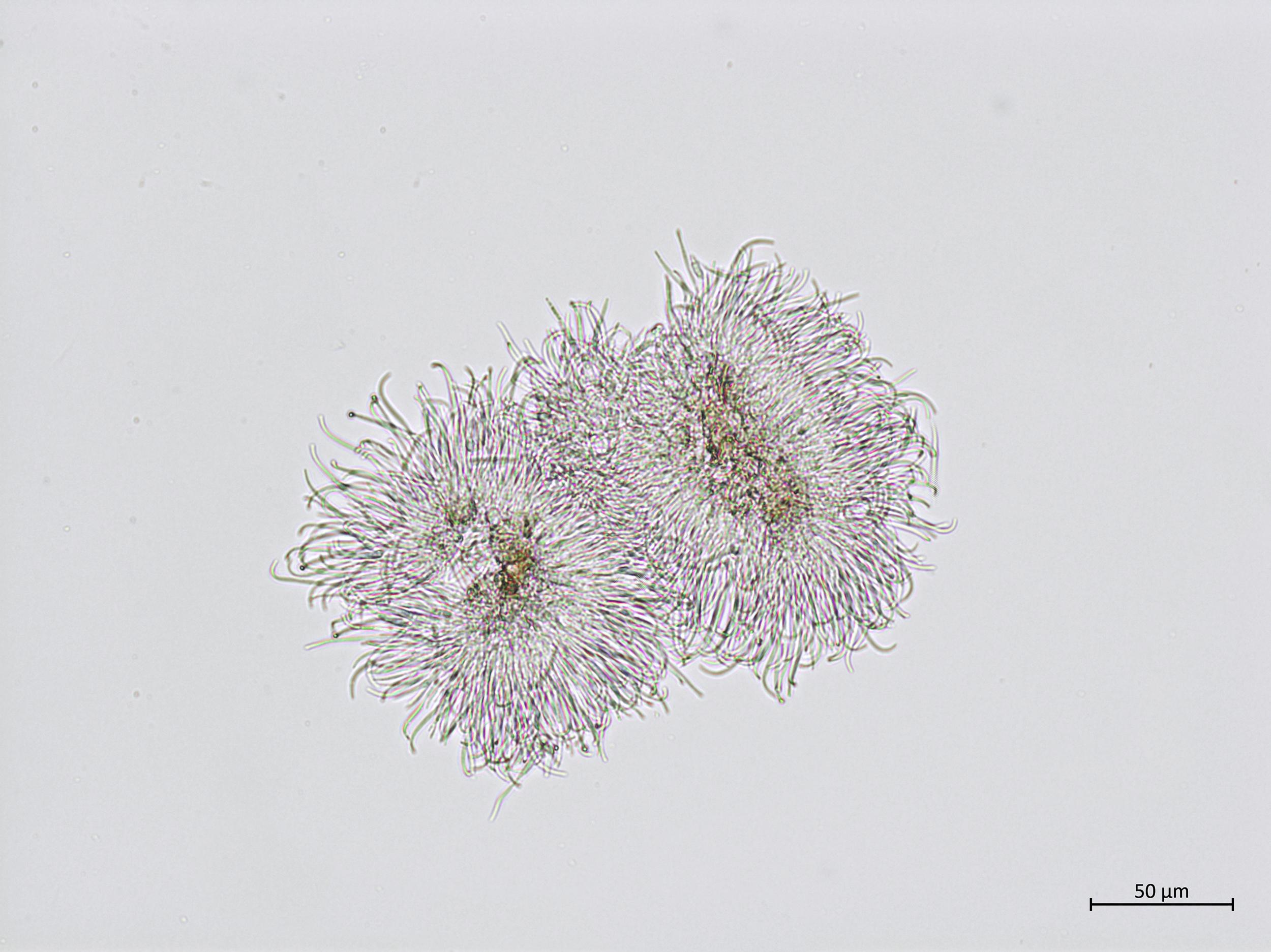 Phomopsis_sp_10
