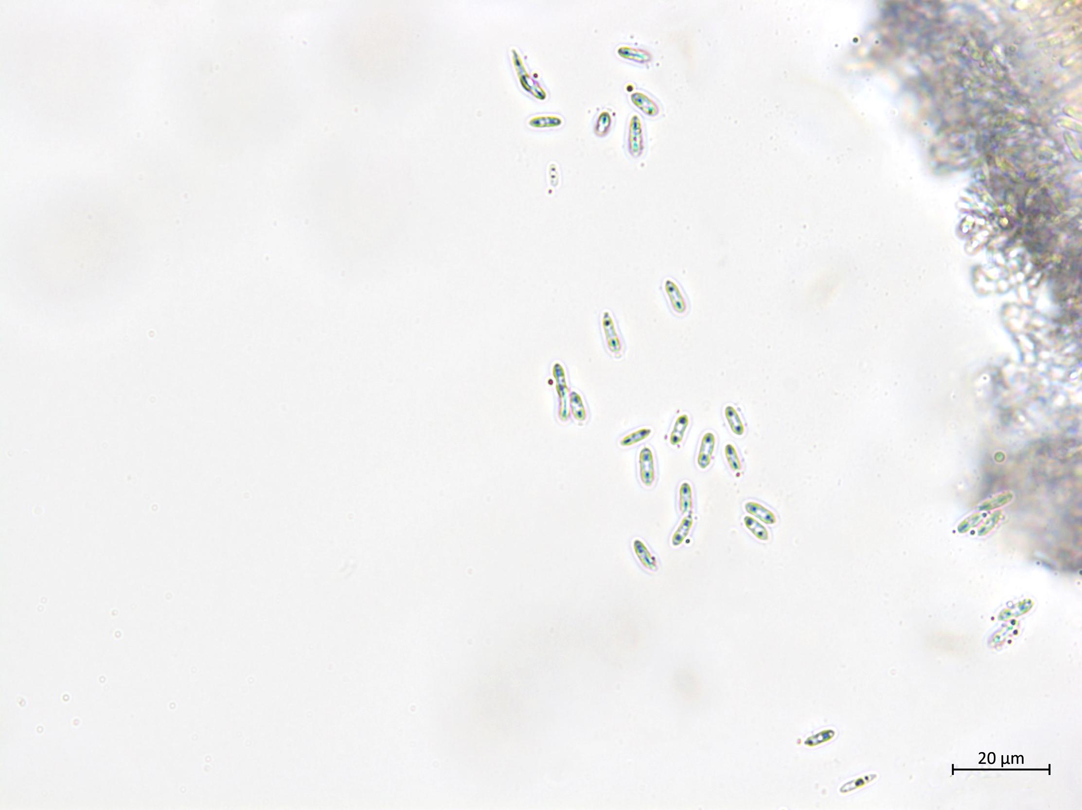 Phomopsis_sp_13