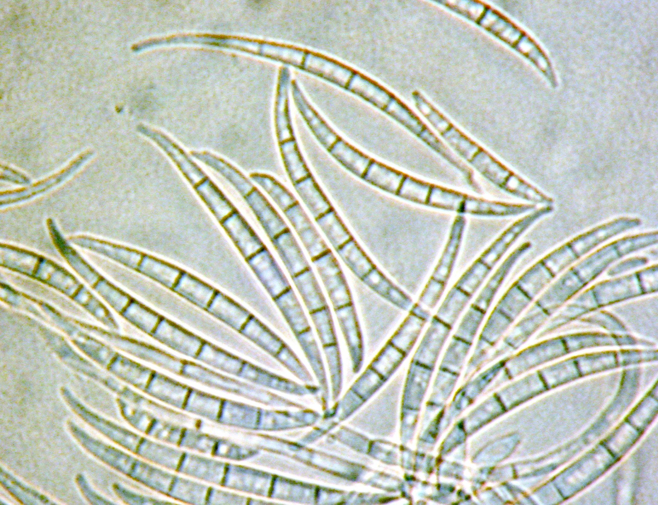 Fusarium_acuminatum_2