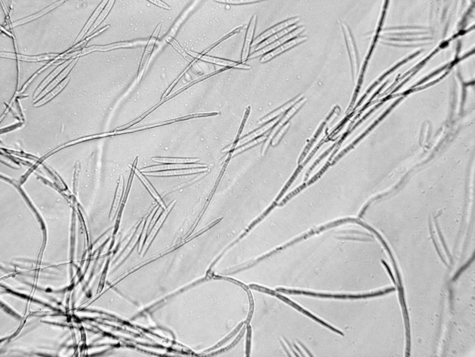 Fusarium_avenaceum_2