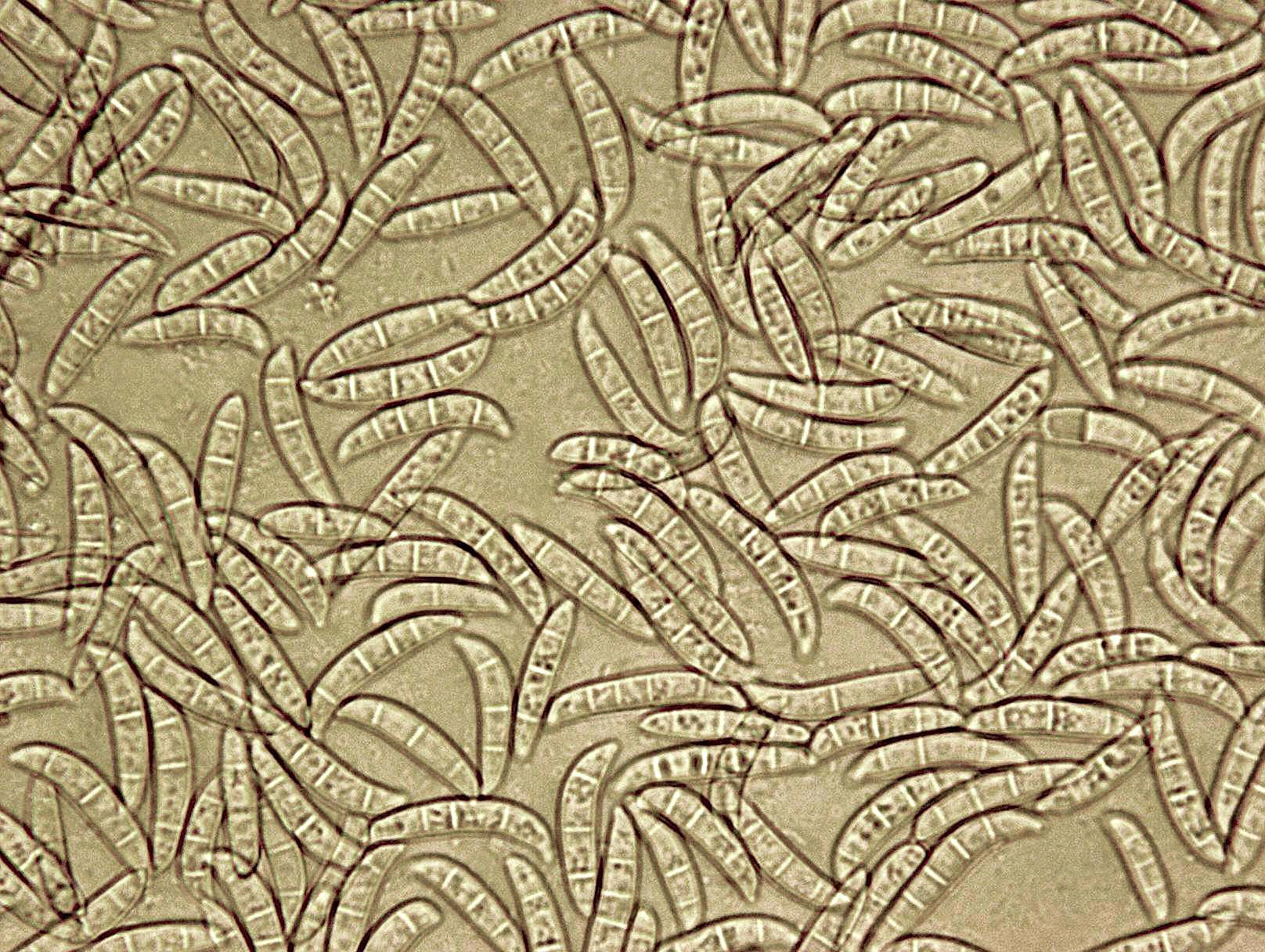 Fusarium_culmorum_1