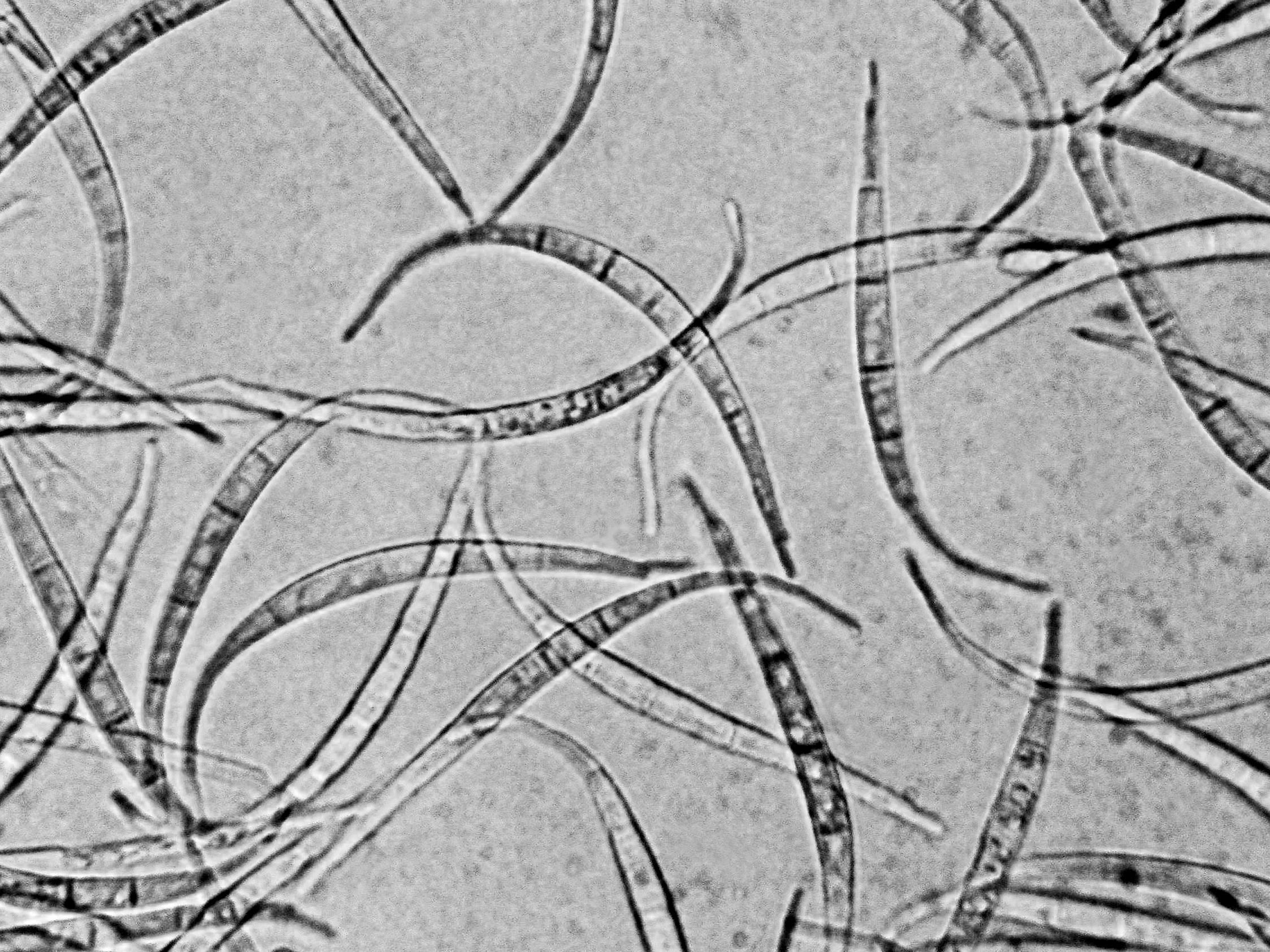 Fusarium_equiseti_1