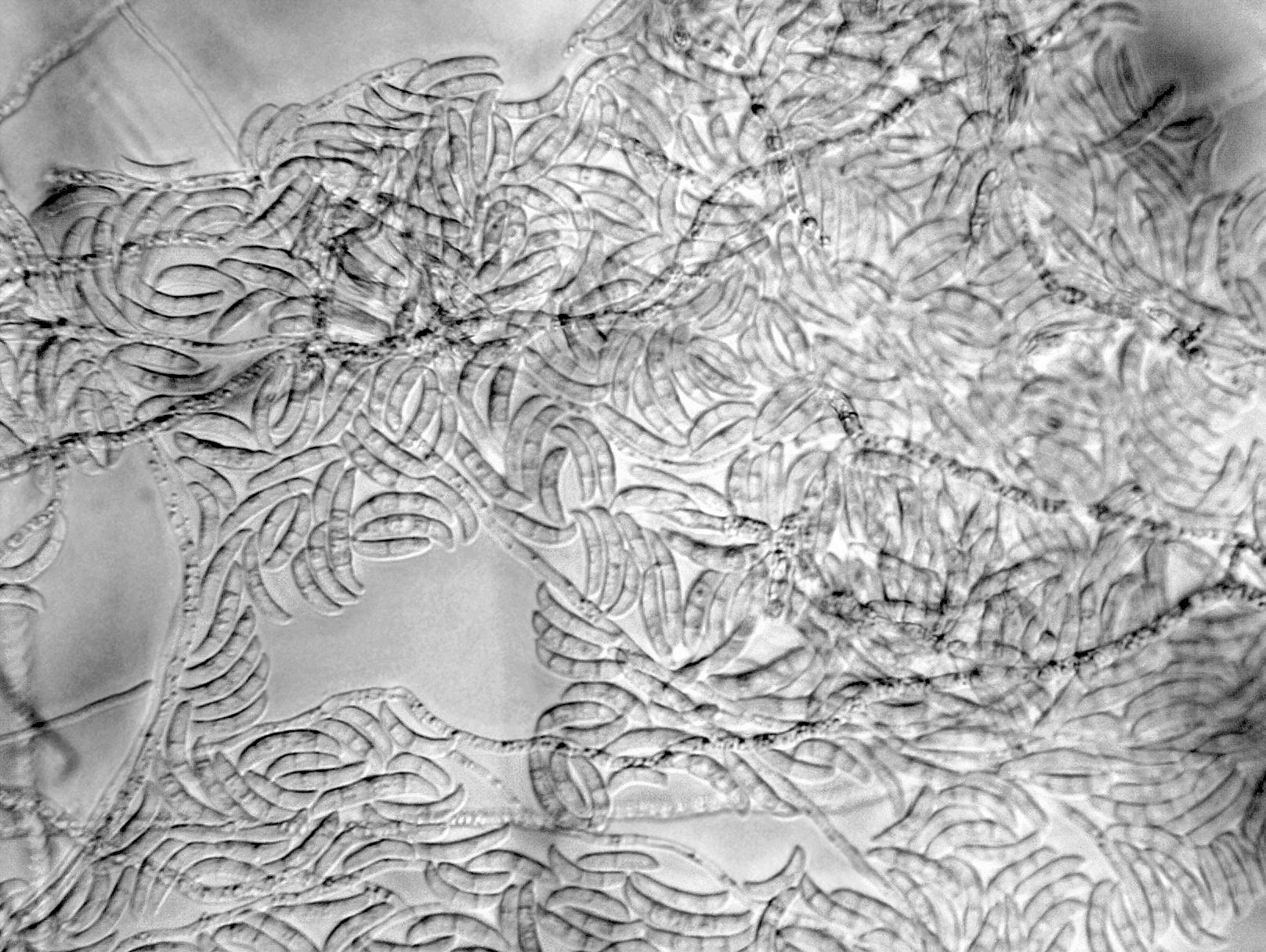 Fusarium_sp_1
