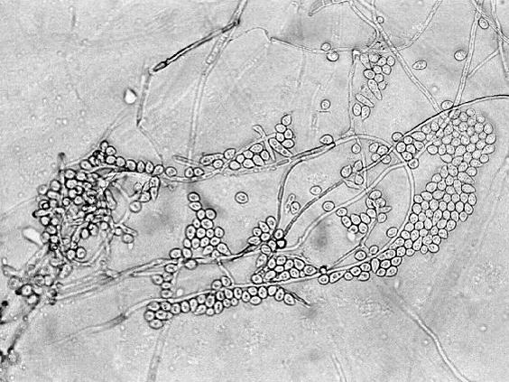 Fusarium_poae_1