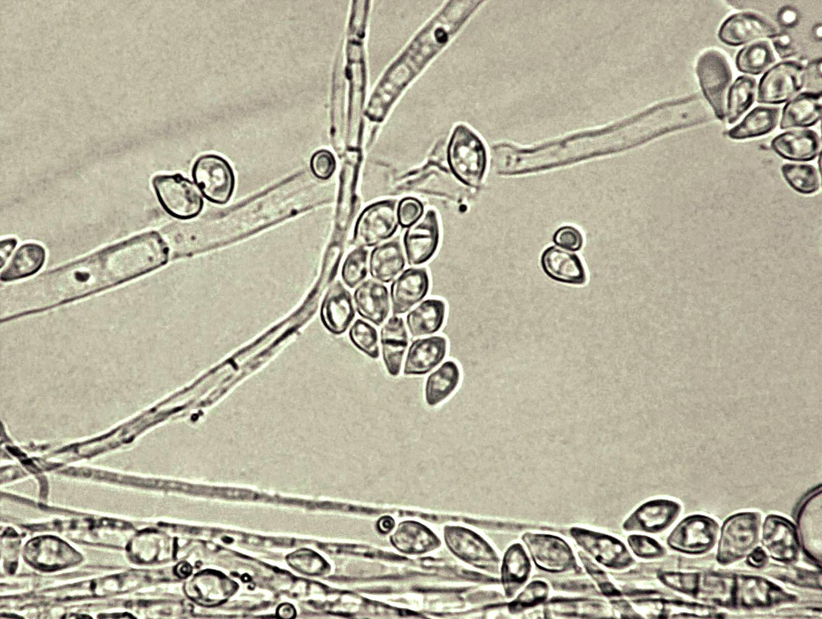 Fusarium_tricinctum_2