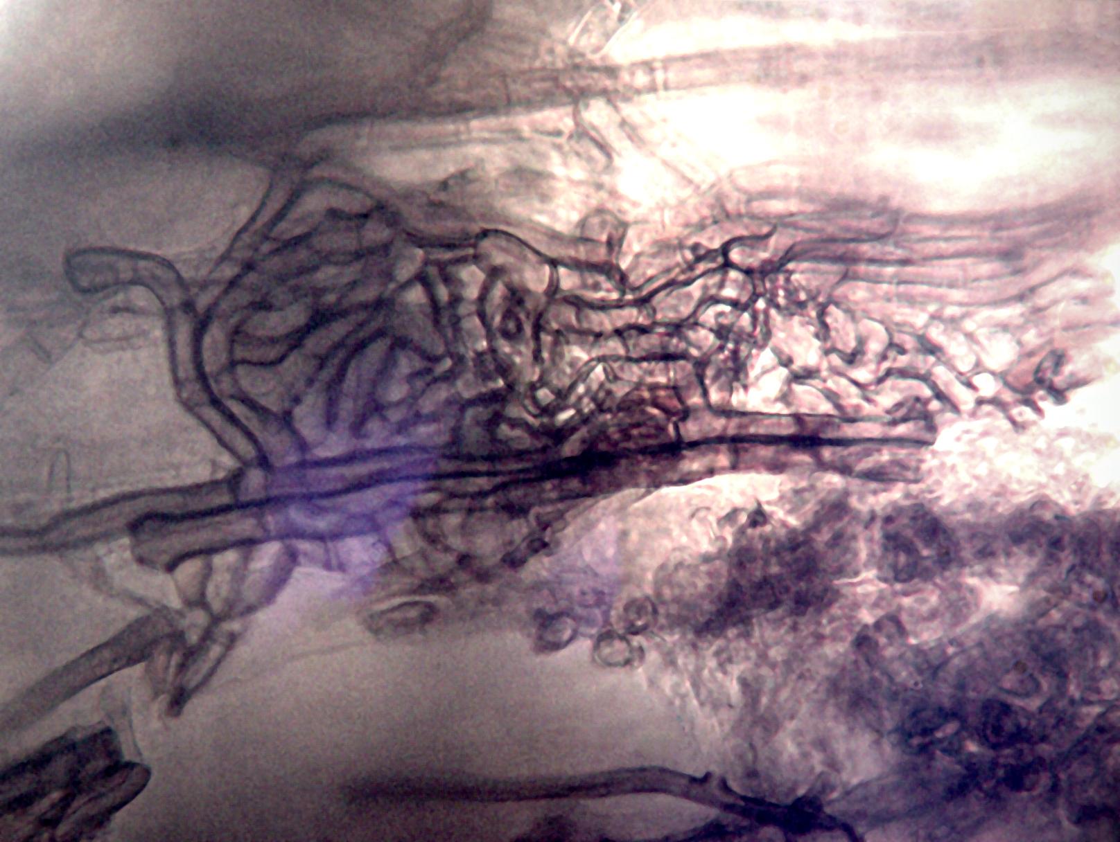 Gaeumannomyces_sp_3