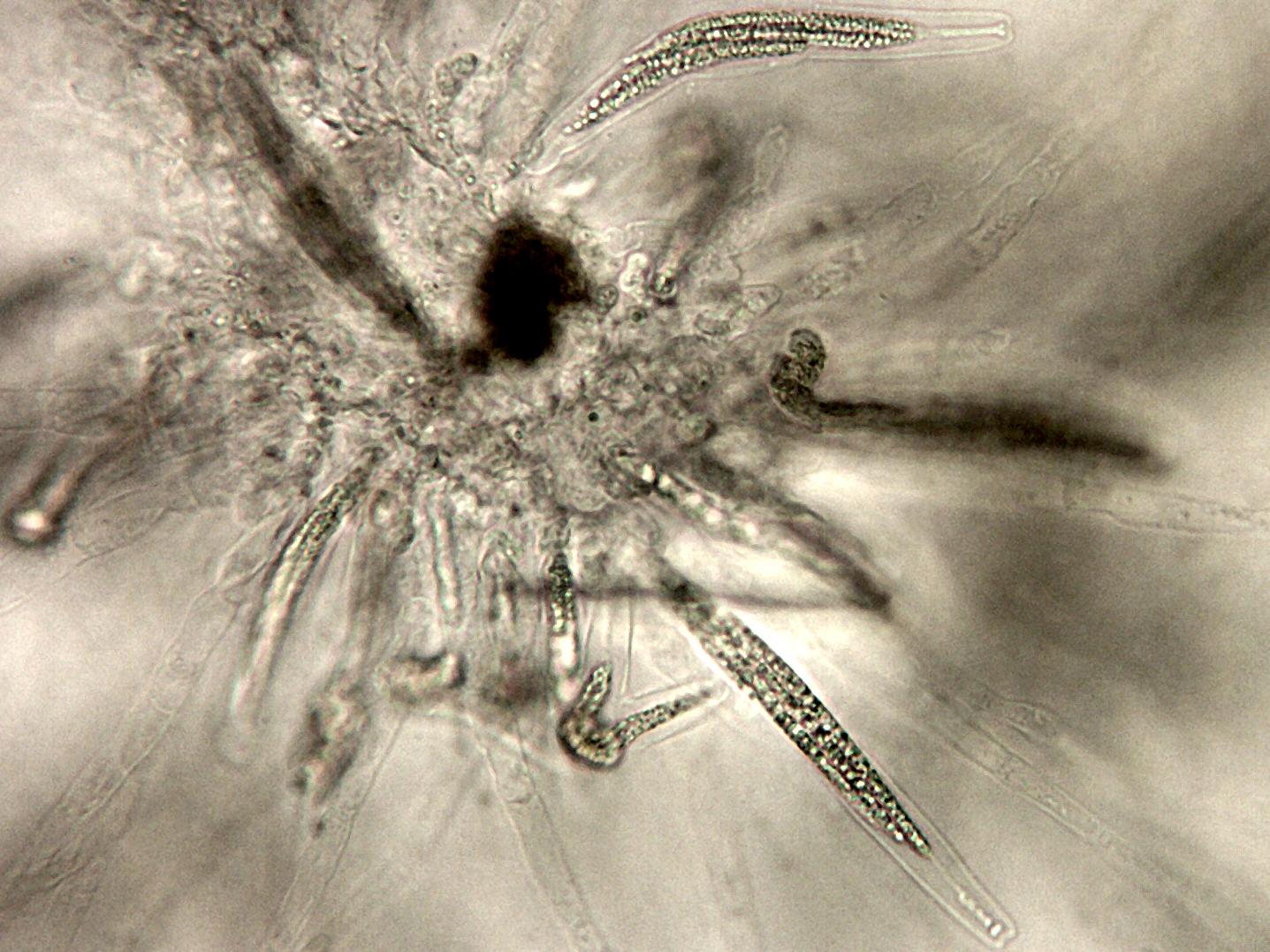 Gaeumannomyces_sp_4