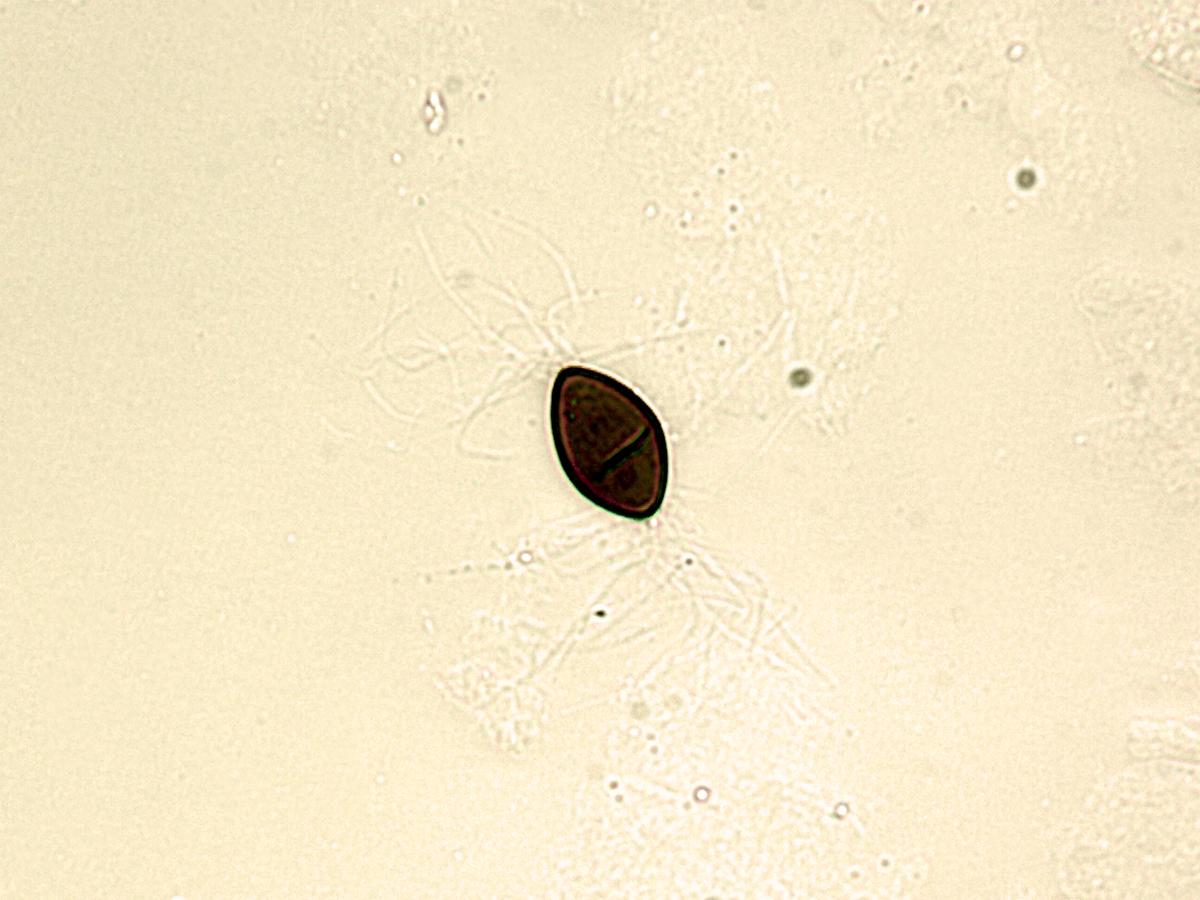 Gilbertella_sp_2