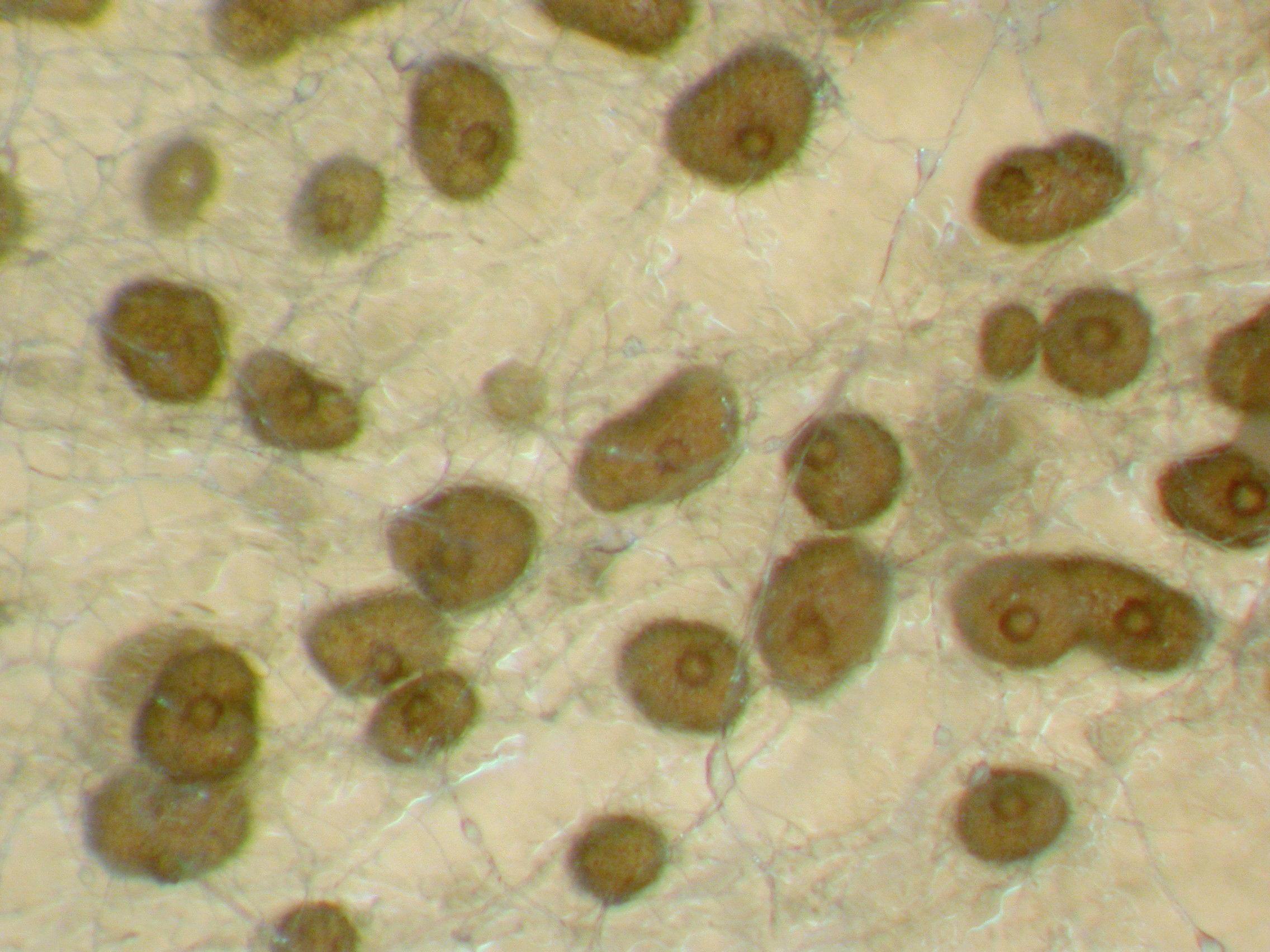 Phoma_sp_4